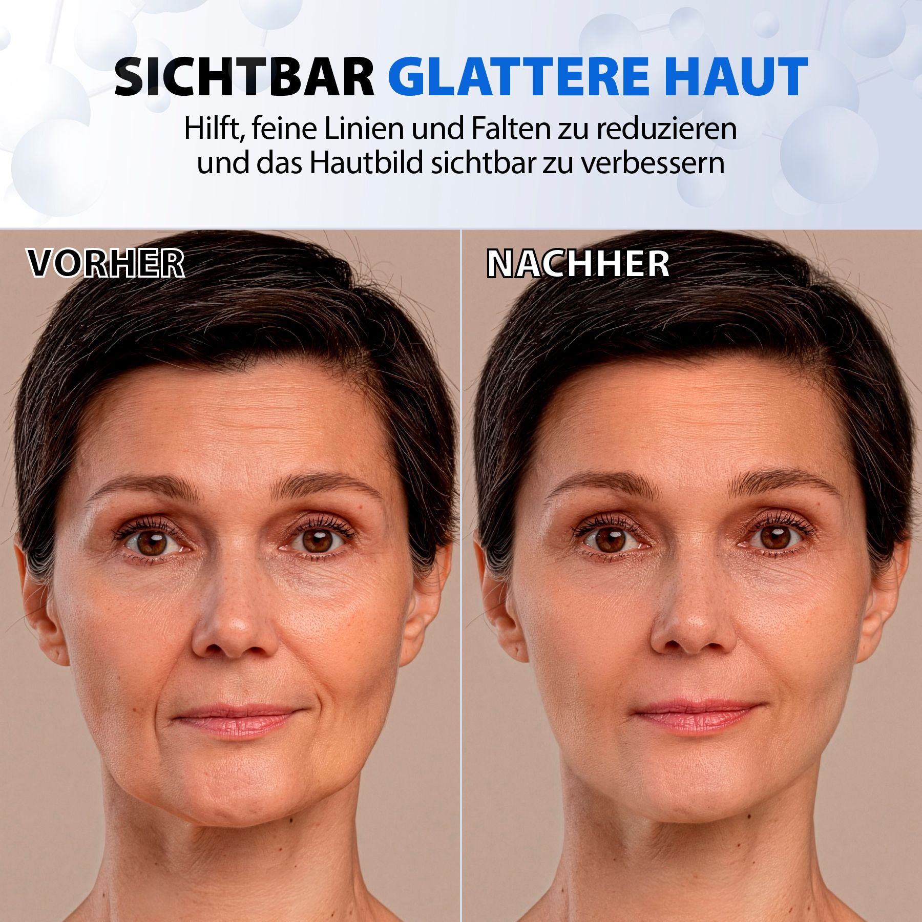 ALIVER Gesichtsserum Botox-Solution Anti-Aging für Gesicht