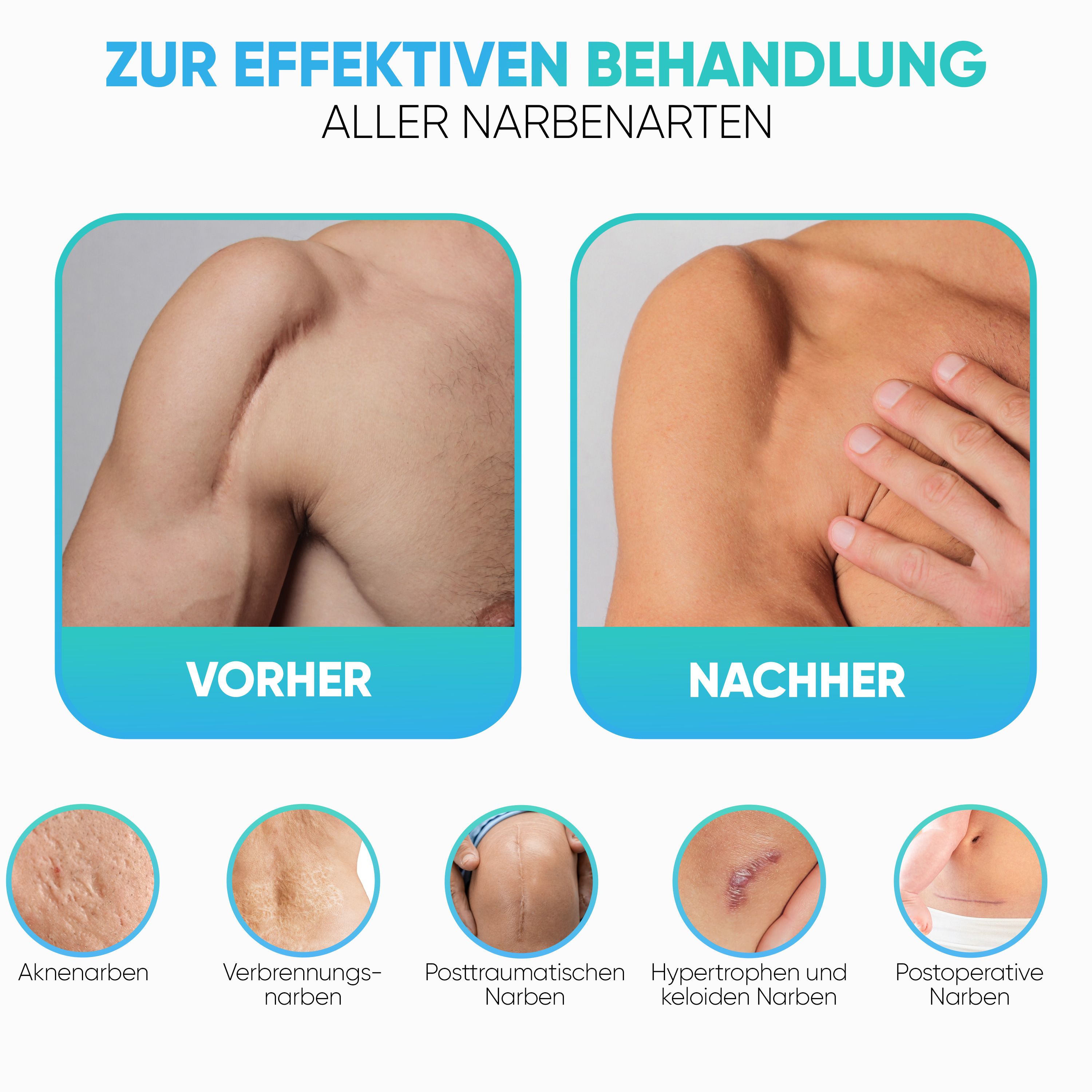 Health Press® Narben Gel