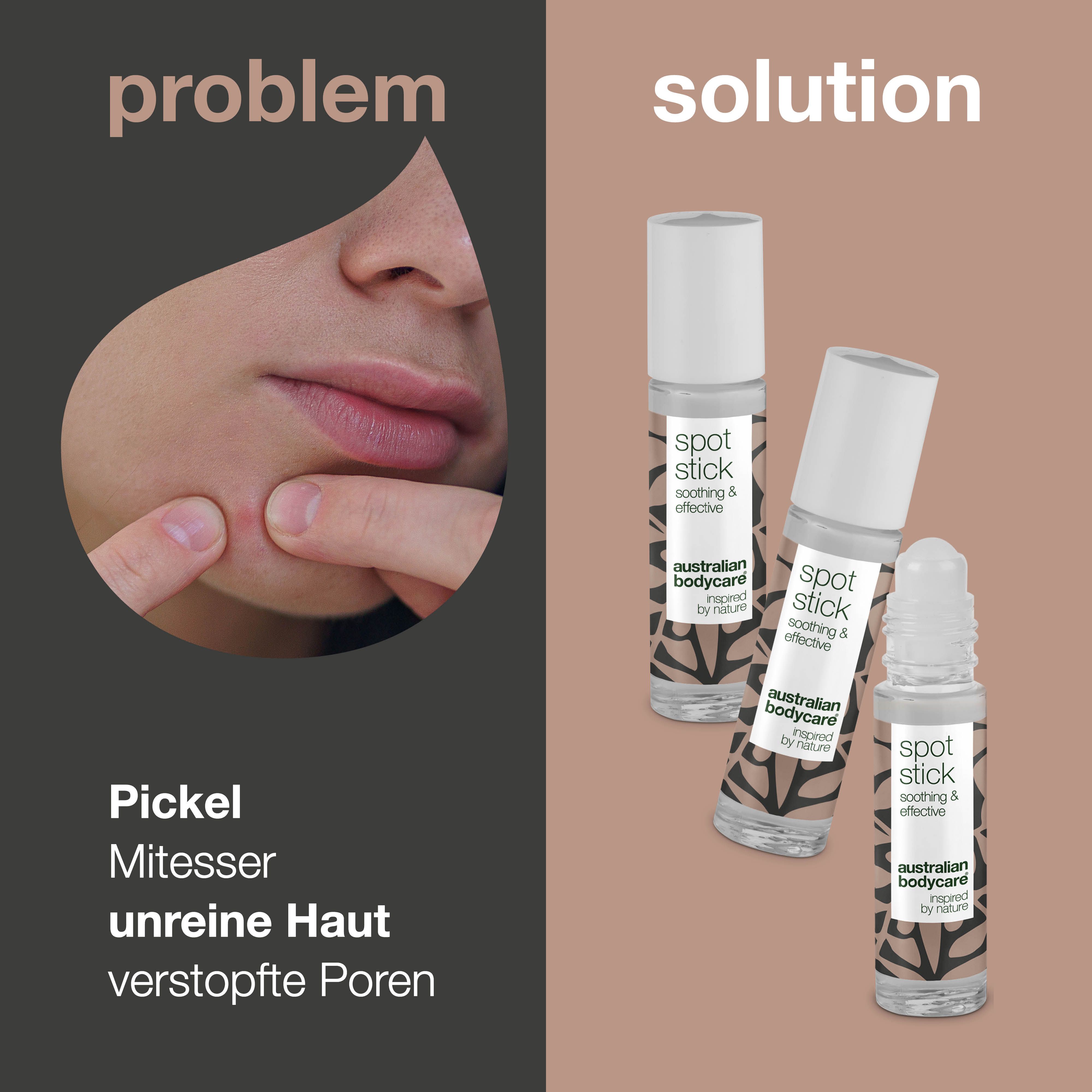 Problem-Lösung-Darstellung. Sichtbar: Spot Stick, beruhigend & effektiv, Australian Bodycare.