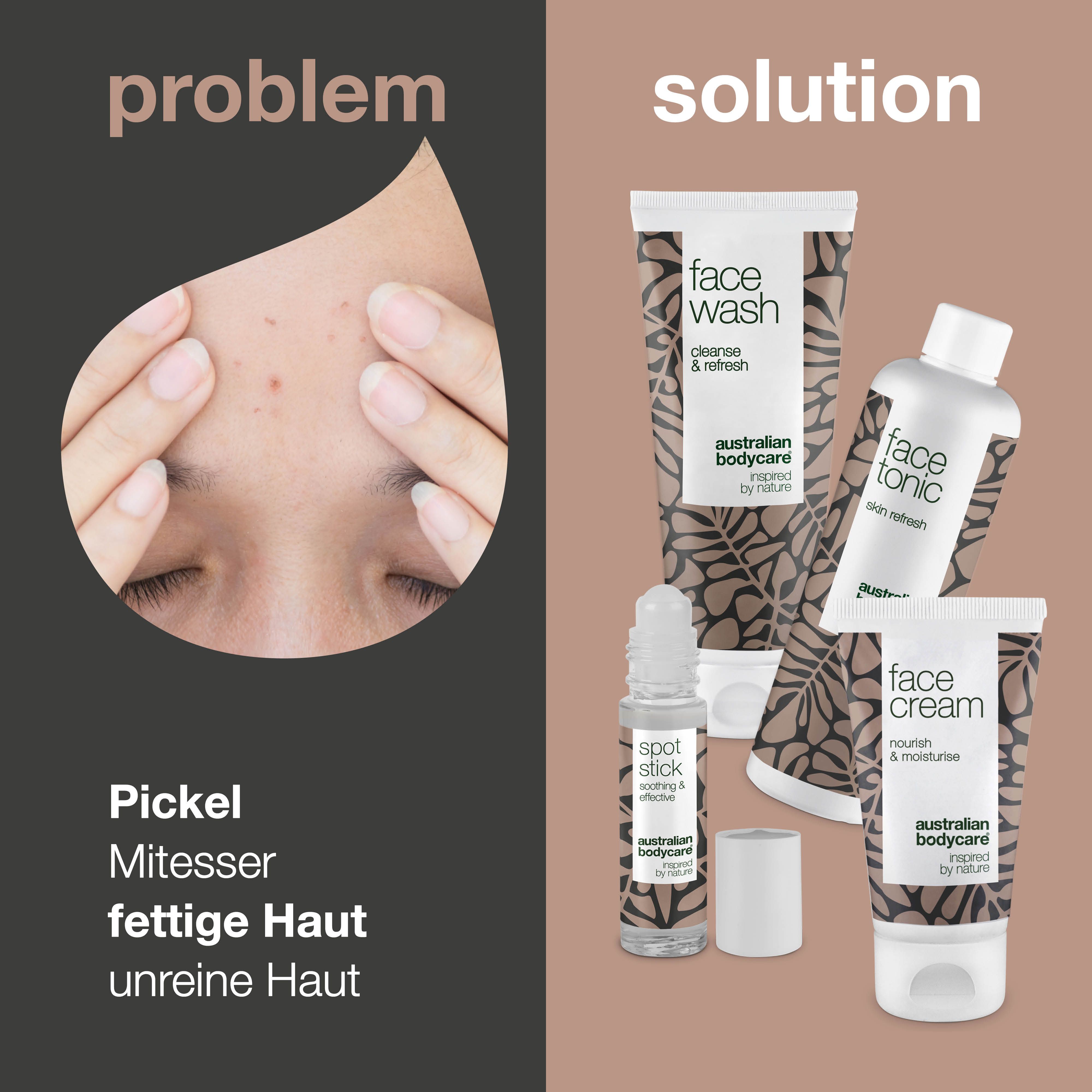 Vergleich von Haut mit Pickeln und Produkten: Face Wash, Face Tonic, Face Cream und Spot Stick. Text.