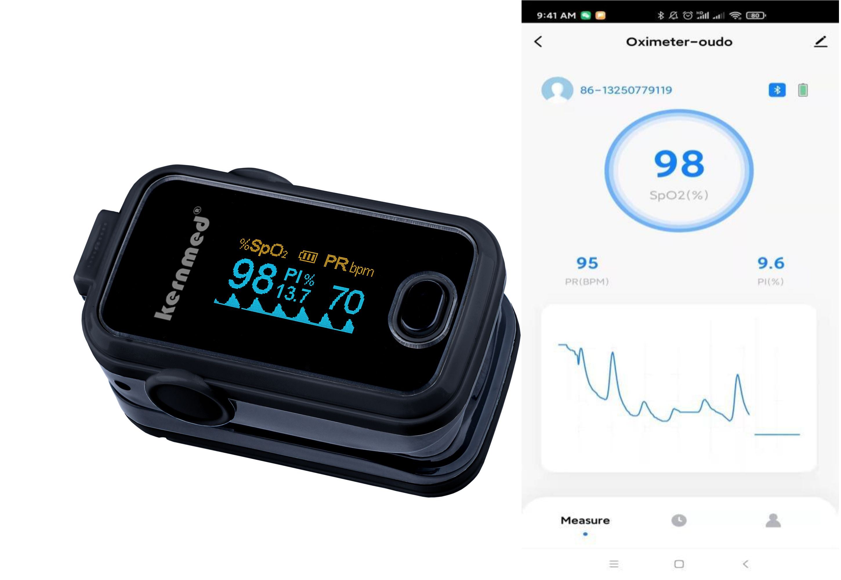 Kernmed OLED Finger Pulsoximeter A310B BLUETOOTH schwarz-Alarm-Signalton plus Zubehör