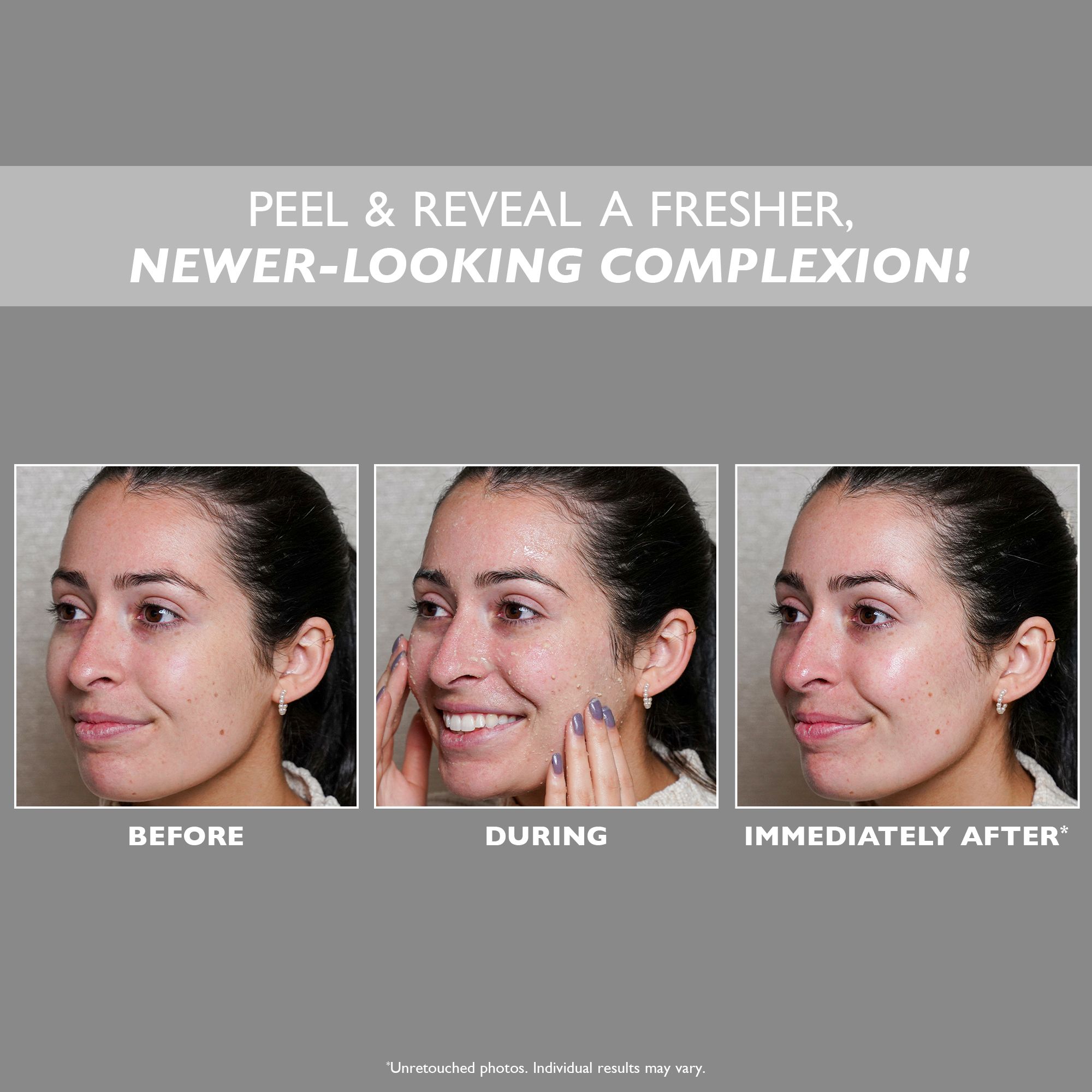 Drei Fotos: Vorher, Während, Sofort danach. Text: PEEL & REVEAL A FRISHER, NEWER-LOOKING COMPLEXION! Frau mit Hautunreinheiten, Gesichtsausdruck verändert sich.