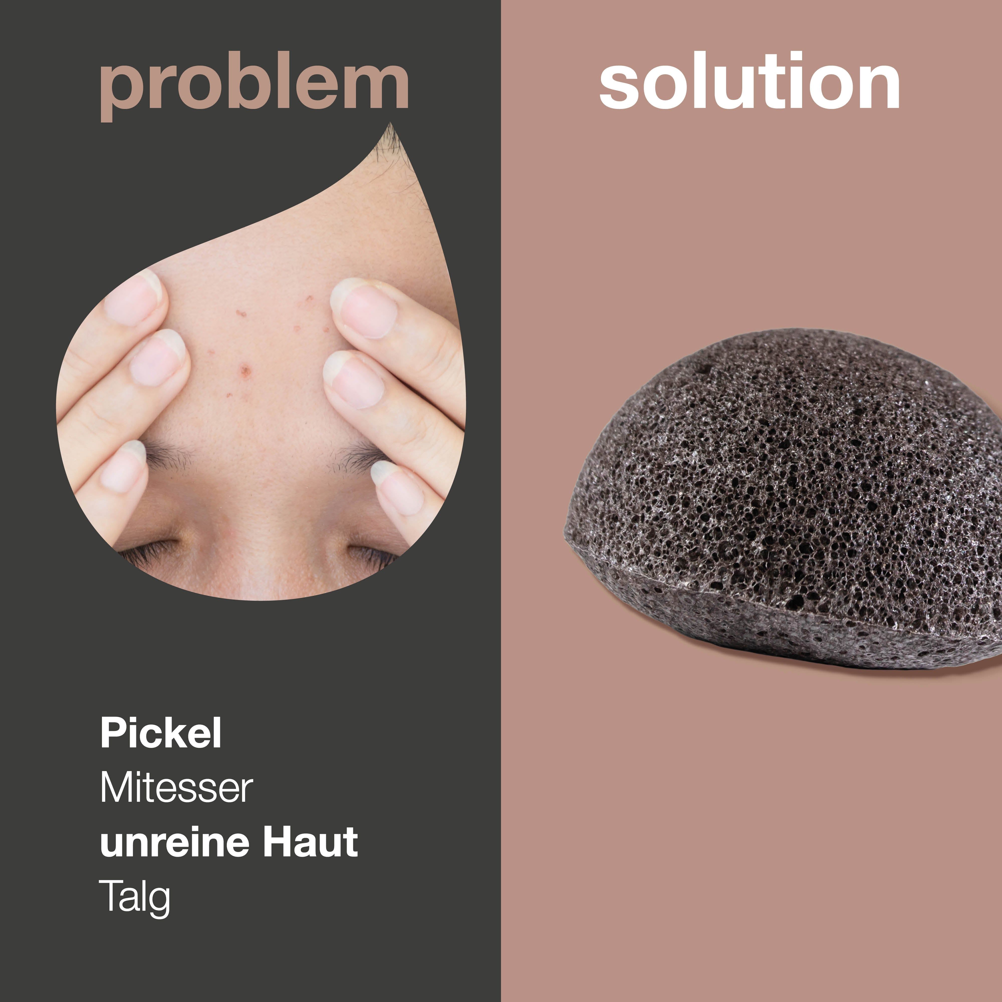 Konjac-Schwamm neben Haut mit Pickeln. Text: Problem, Lösung. Pickel, Mitesser, unreine Haut, Talg.