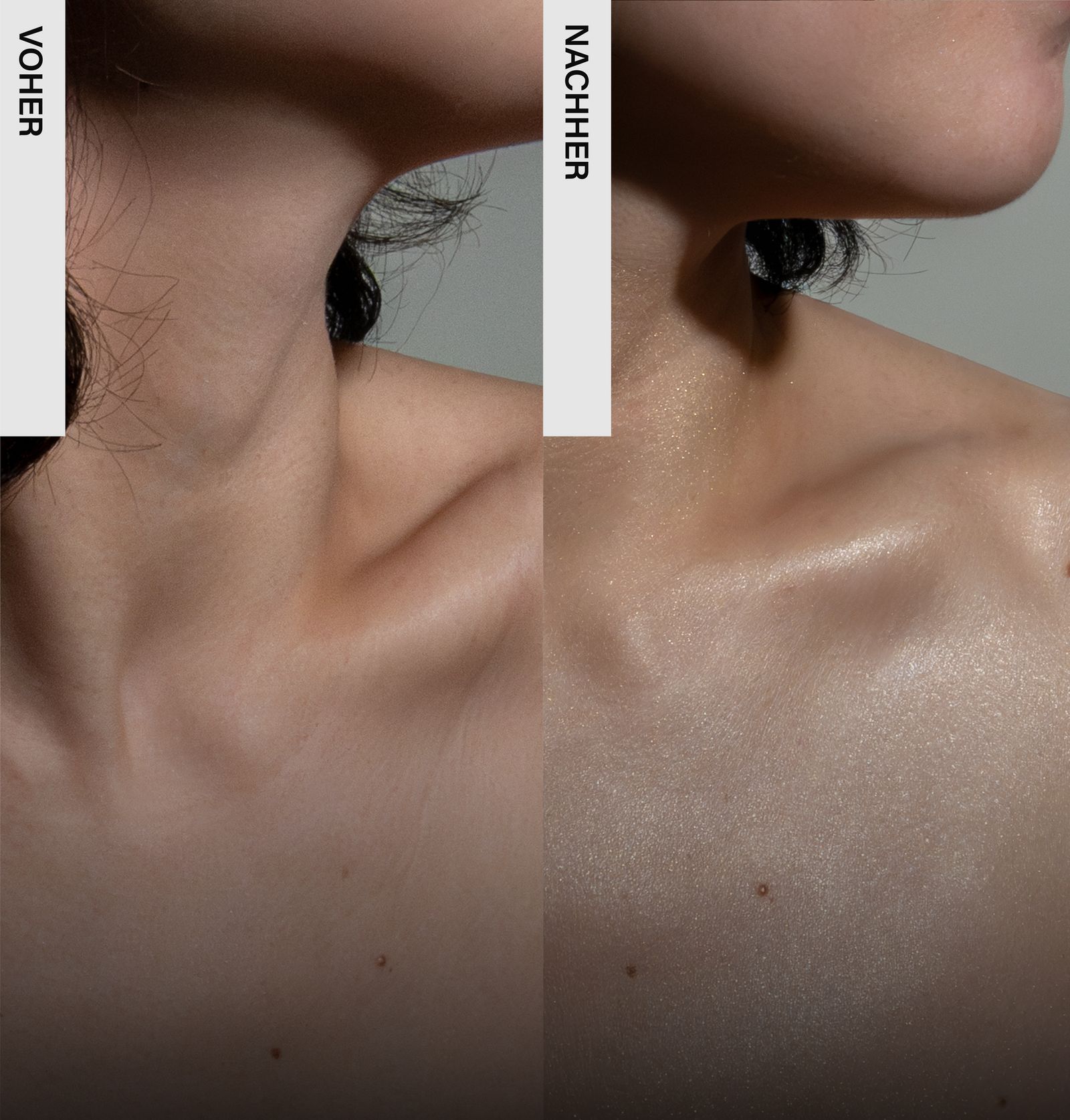 Vergleich von Hals und Dekolleté vor und nach der Anwendung. Haut wirkt glatter und strahlender.