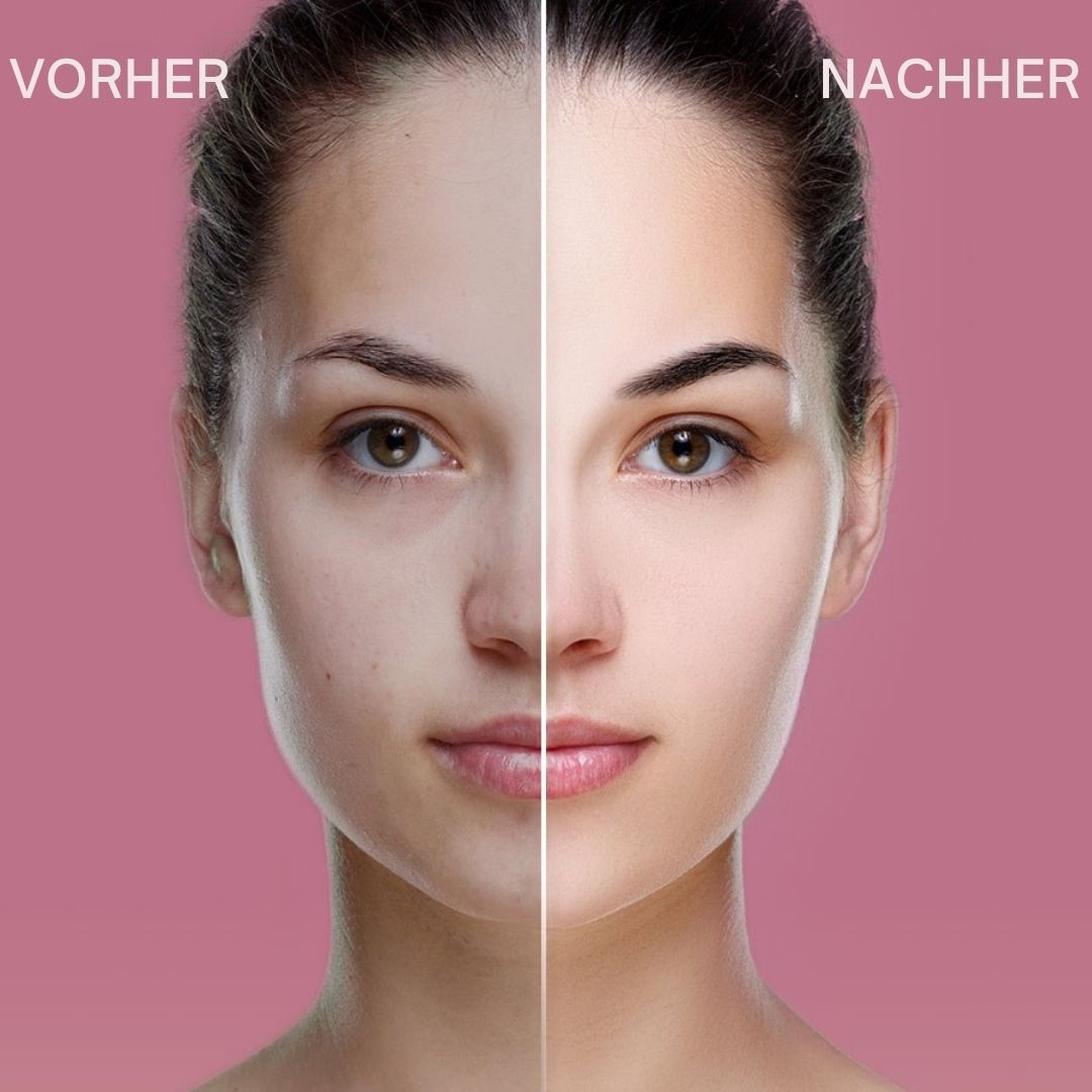 Vorher-Nachher-Bild einer Frau. Die linke Gesichtshälfte zeigt Hautunreinheiten, die rechte eine glatte Haut.