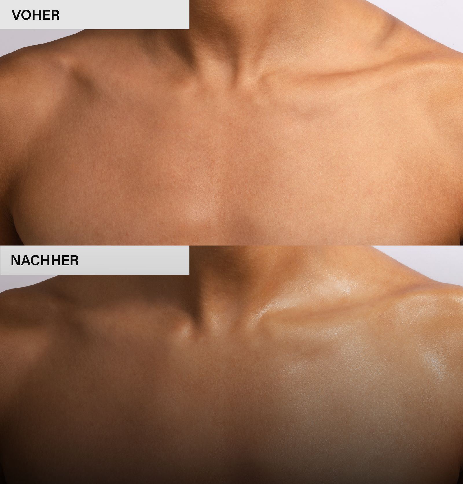 Vorher-Nachher-Vergleich. Obere Hälfte: Haut vor der Behandlung. Untere Hälfte: Haut nach der Behandlung. Deutliche Veränderung.