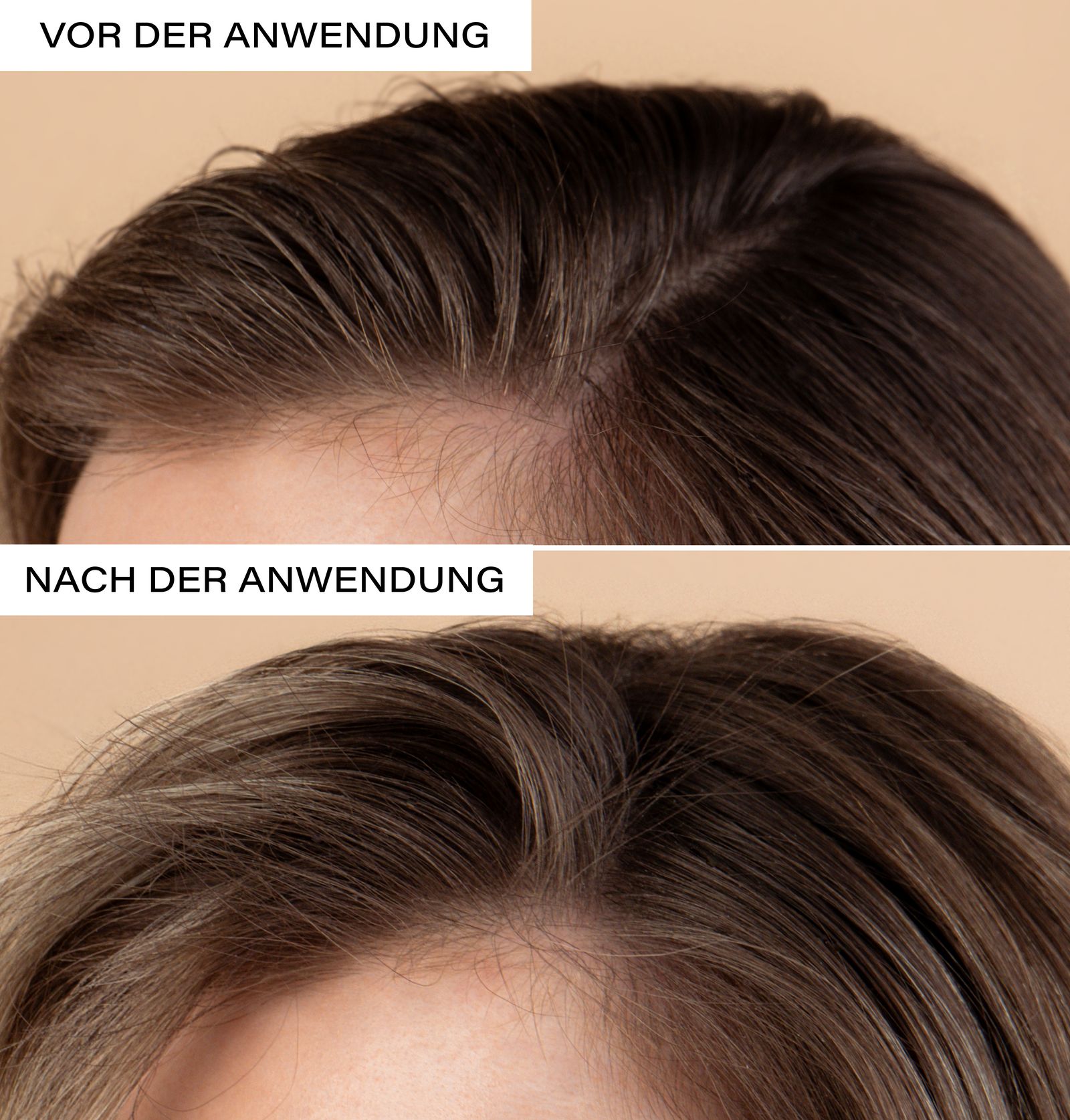 Zwei Nahaufnahmen von Kopfhaut und Haaren. Oben: Vor der Anwendung. Unten: Nach der Anwendung.