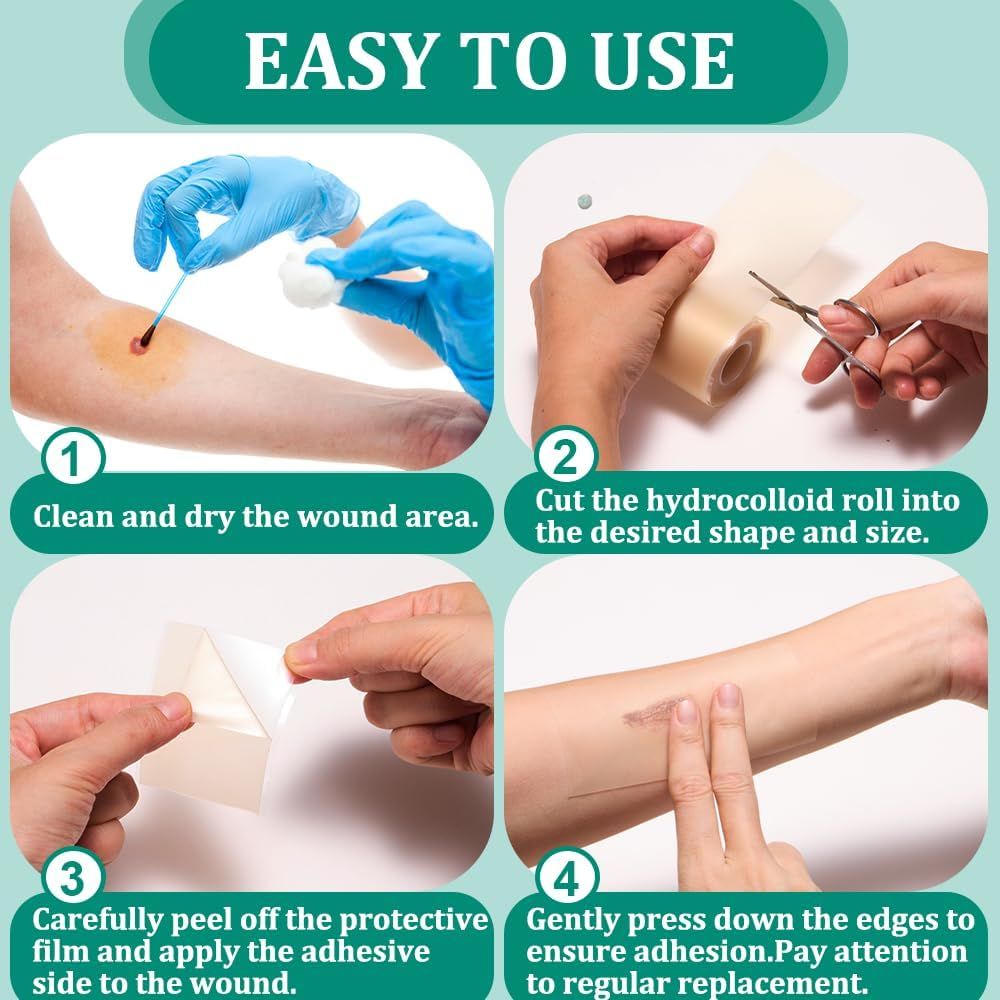 Schritte zur Anwendung von Hydrokolloid-Pflastern: Wunde reinigen, Pflaster zuschneiden, Schutzfolie abziehen, Pflaster aufkleben.