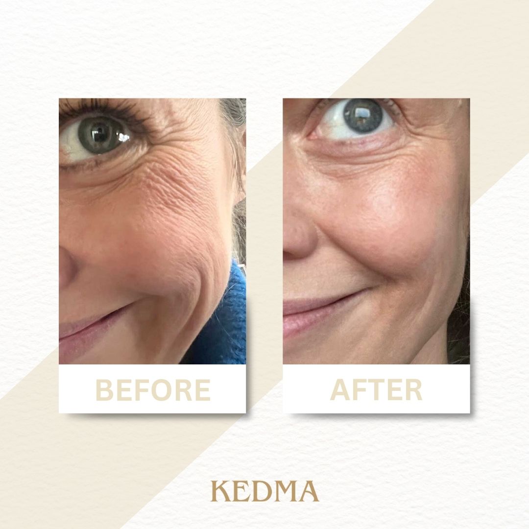 Kedma - Platin Serum mit Q10 & Multivitaminen