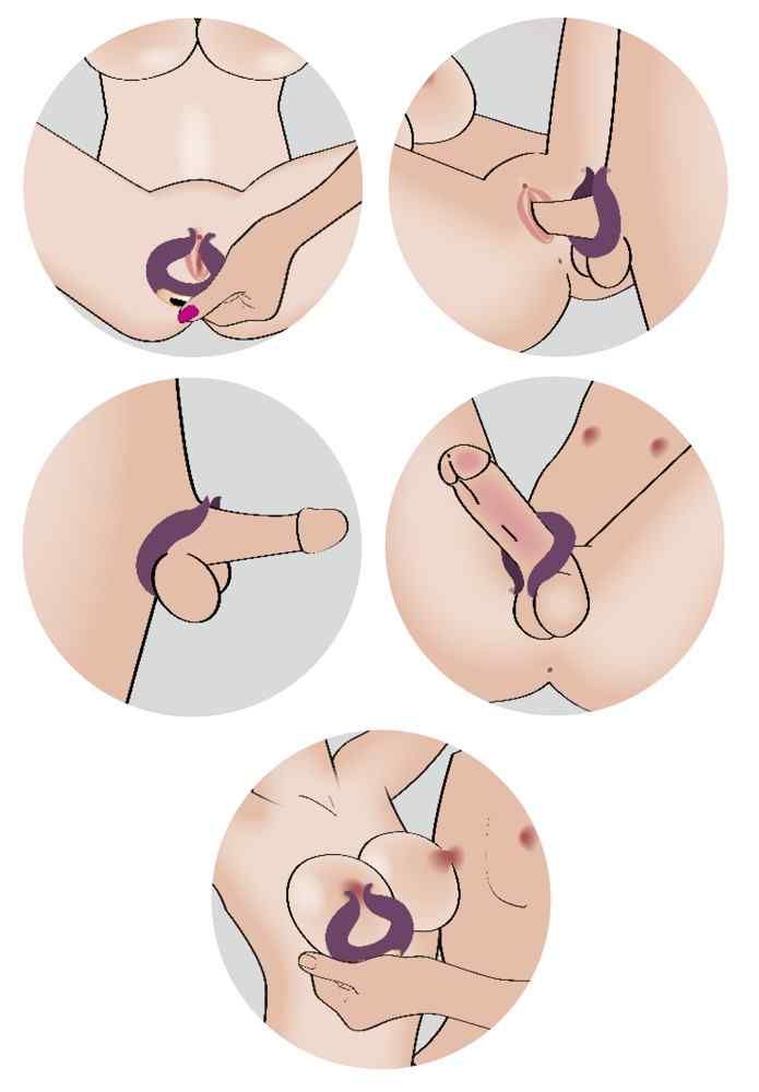 Illustrationen zeigen die Anwendung eines lila Rings. Für intime Zwecke.