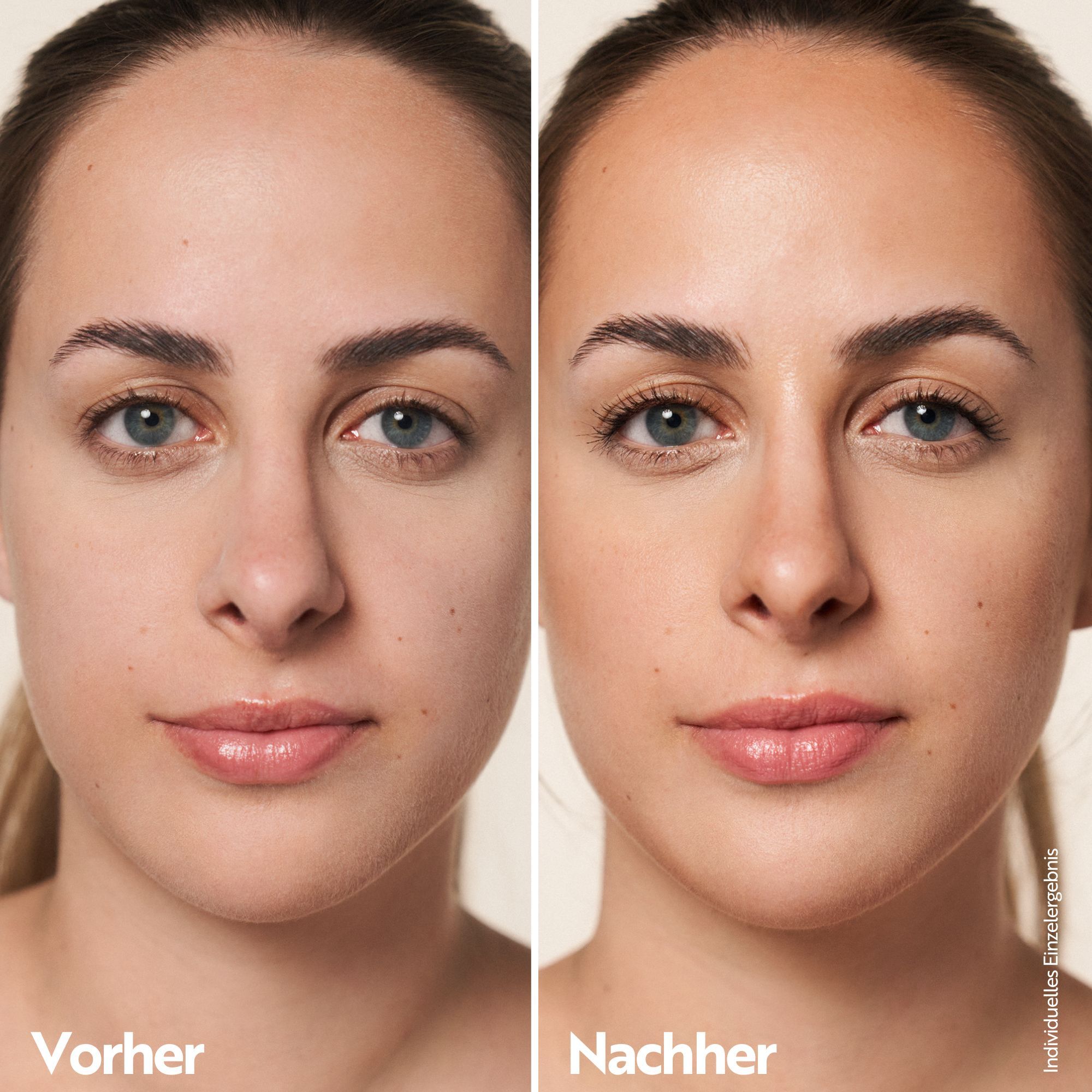 Vorher-Nachher-Vergleich. Gesicht einer Frau ohne und mit Konturierung. Deutlicher Unterschied im Hautton.