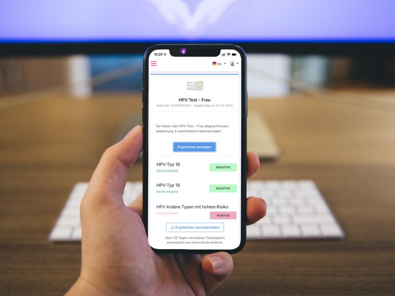 Smartphone mit Testergebnissen. HPV Test - Frau. Ergebnisse: negativ/positiv. Hintergrund: Tisch und Tastatur.