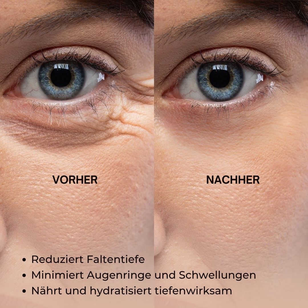 Vorher-Nachher-Bild von Augen. Reduzierte Faltentiefe, minimierte Augenringe. Text: Anti-Aging Face Serum.