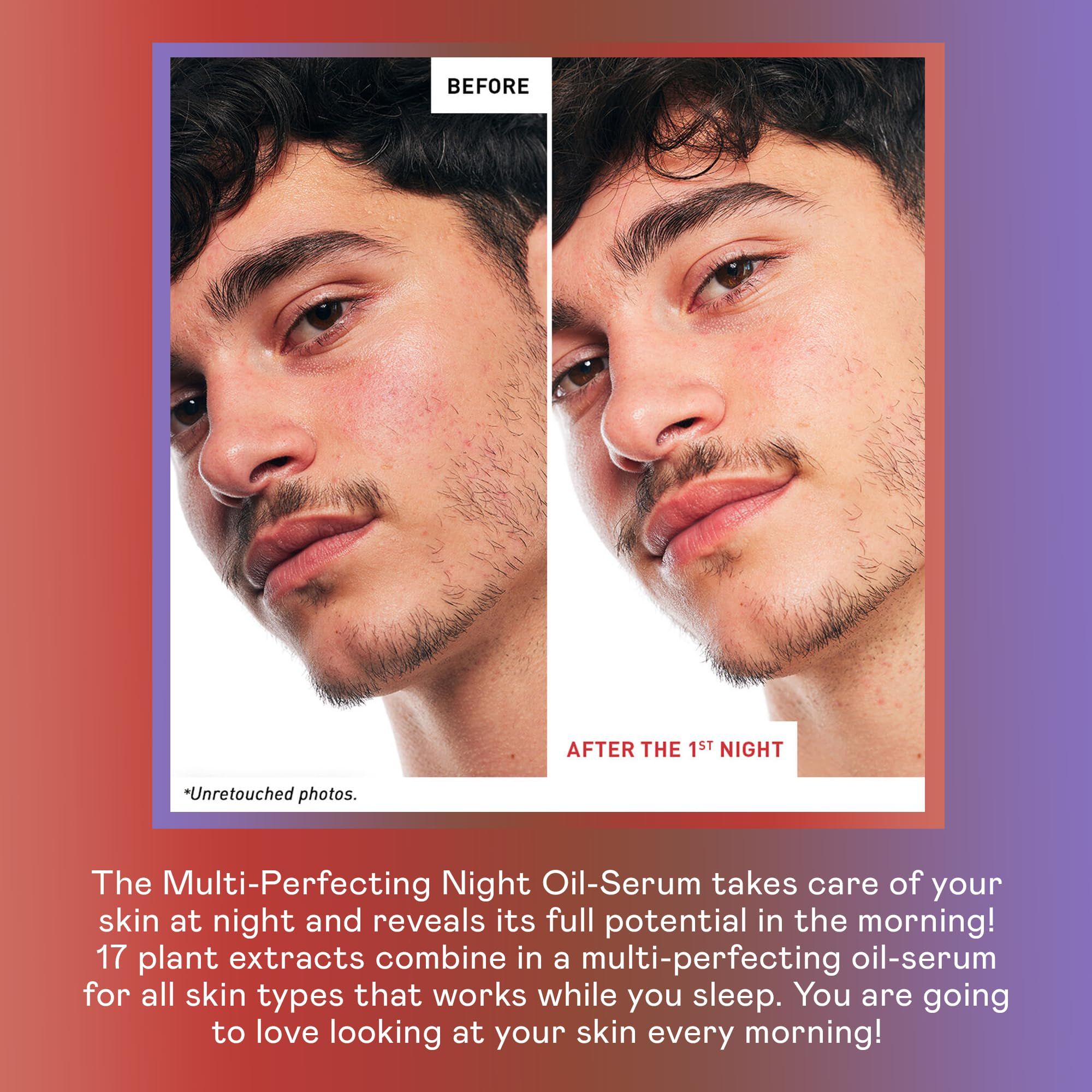 Vorher-Nachher-Vergleich. Gesicht eines Mannes vor und nach der Anwendung. Text: Multi-Perfecting Night Oil-Serum.