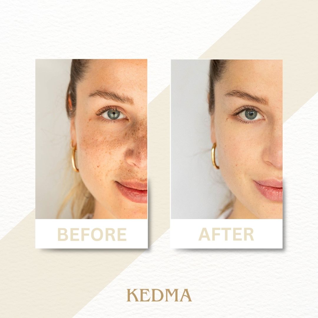 Kedma - Nachtcreme mit Mineralien & Retinol