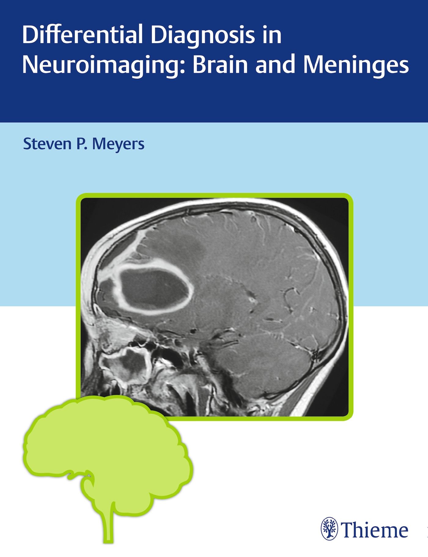 Buchcover mit Titel: Differential Diagnosis in Neuroimaging: Brain and Meninges. Autor: Steven P. Meyers. Abbildung eines Gehirn-Scans.