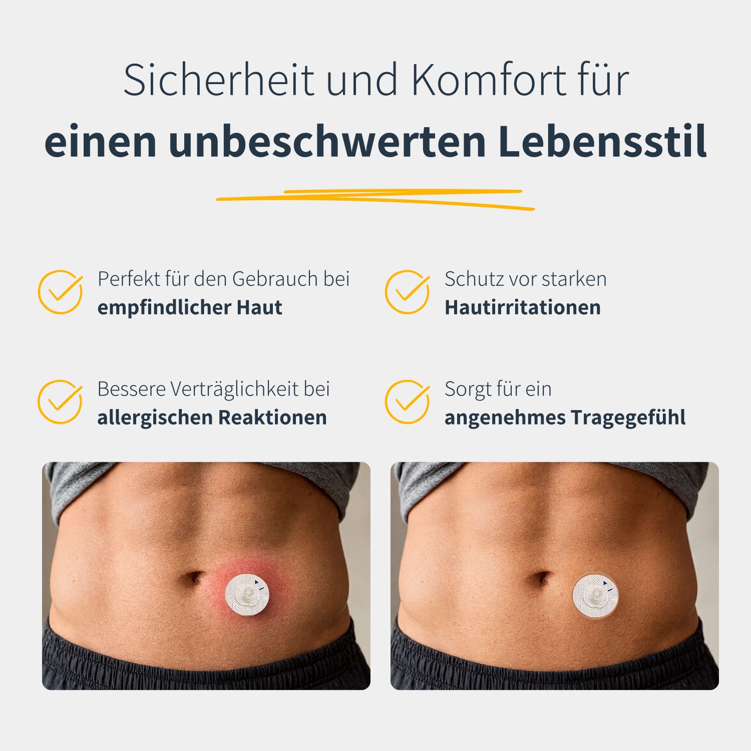 Bauchansicht mit Katheter-Underpatch. Links: Rötung. Rechts: Patch ohne Rötung. Text: Sicherheit und Komfort.