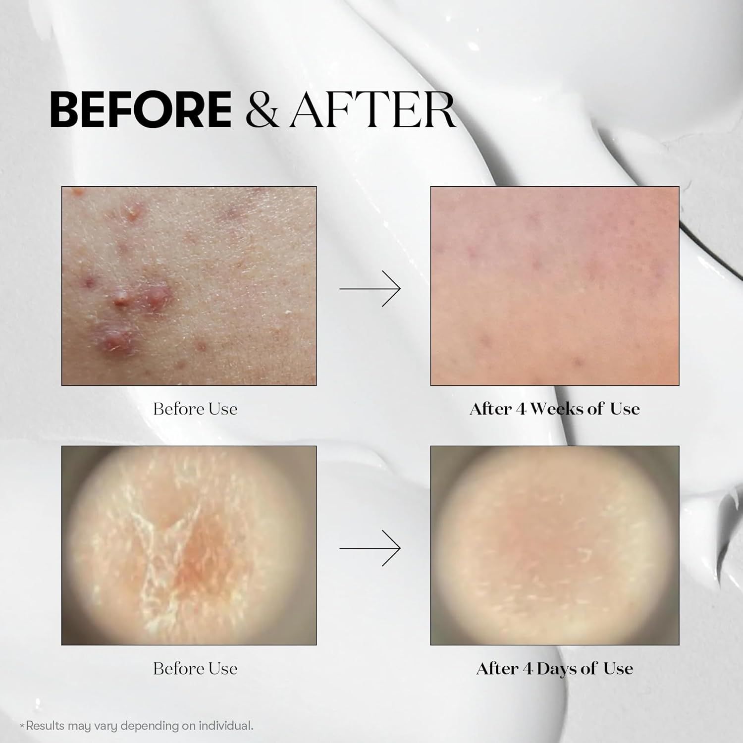 VT COSMETICS 100 Reedle Shot