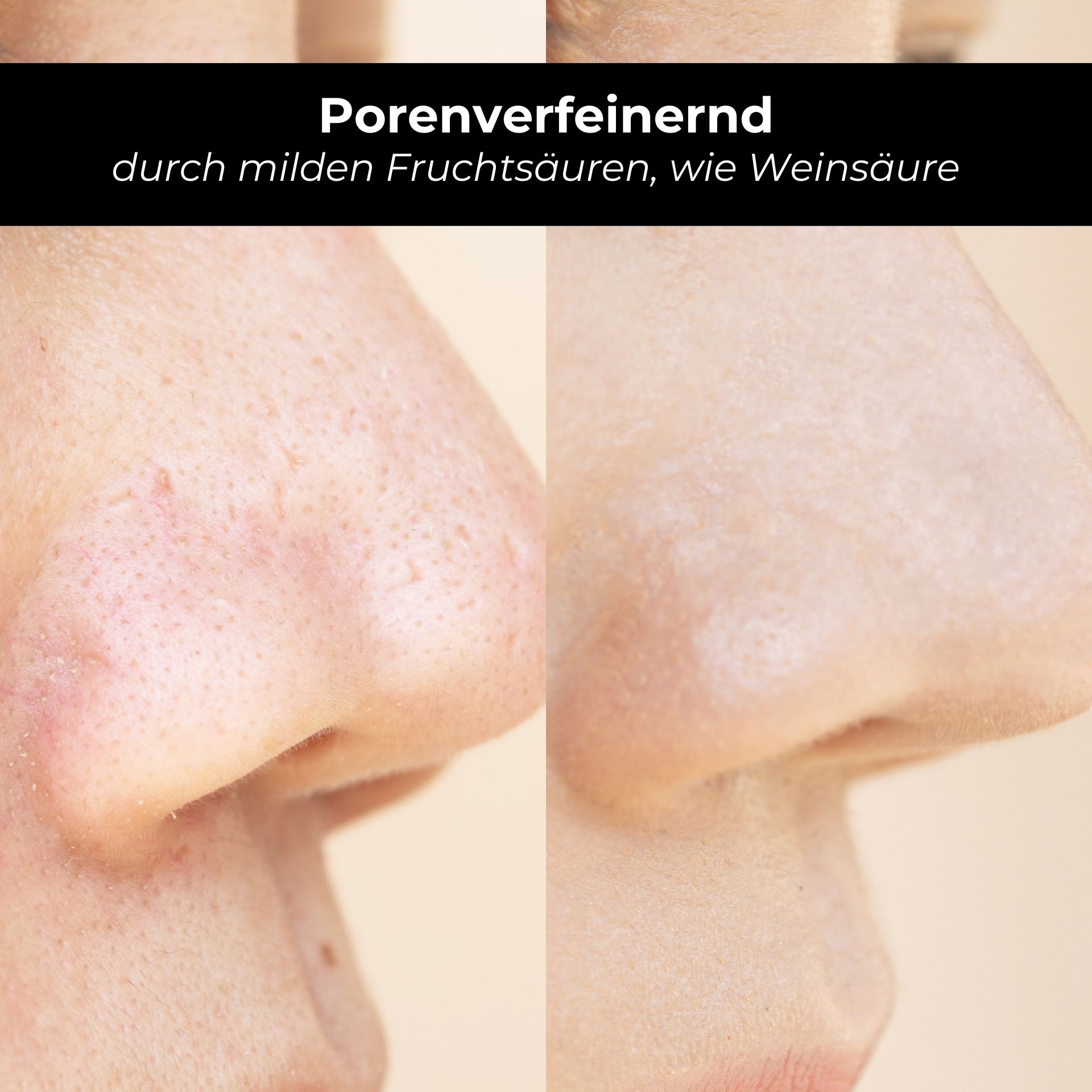 Nahaufnahme von Nasen. Text: Porenverfeinernd durch milden Fruchtsäuren, wie Weinsäure.