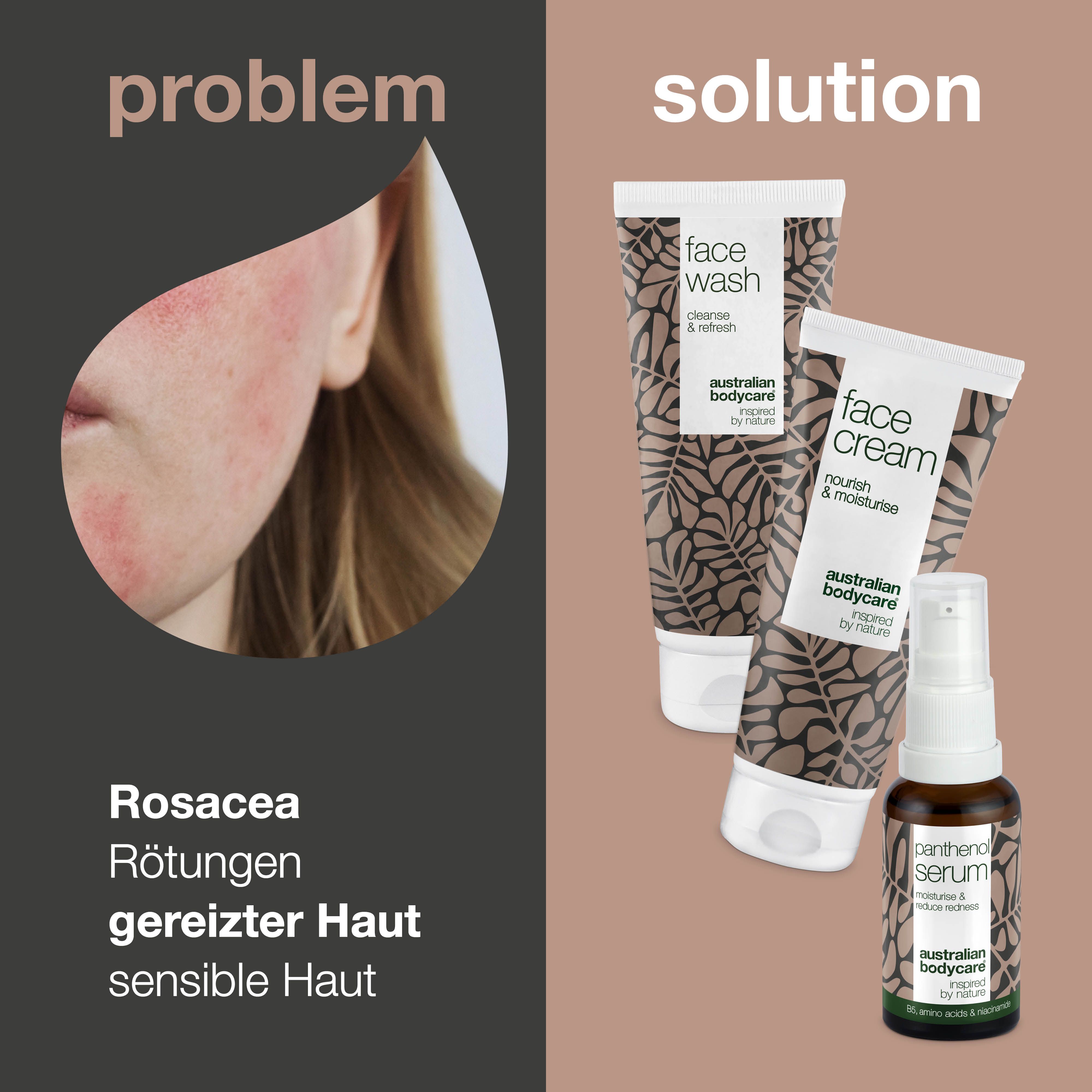Bild zeigt Gesicht mit Rötungen und Produkte: Face Wash, Face Cream und Serum. Text: Rosacea, Rötungen, gereizte Haut.