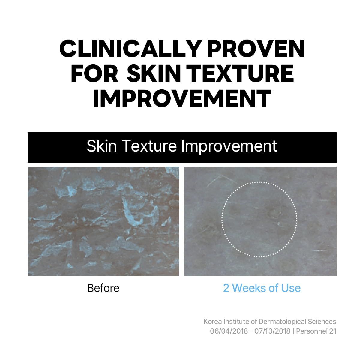 Vergleich von Hauttexturen vor und nach 2 Wochen Anwendung. Text: Skin Texture Improvement.
