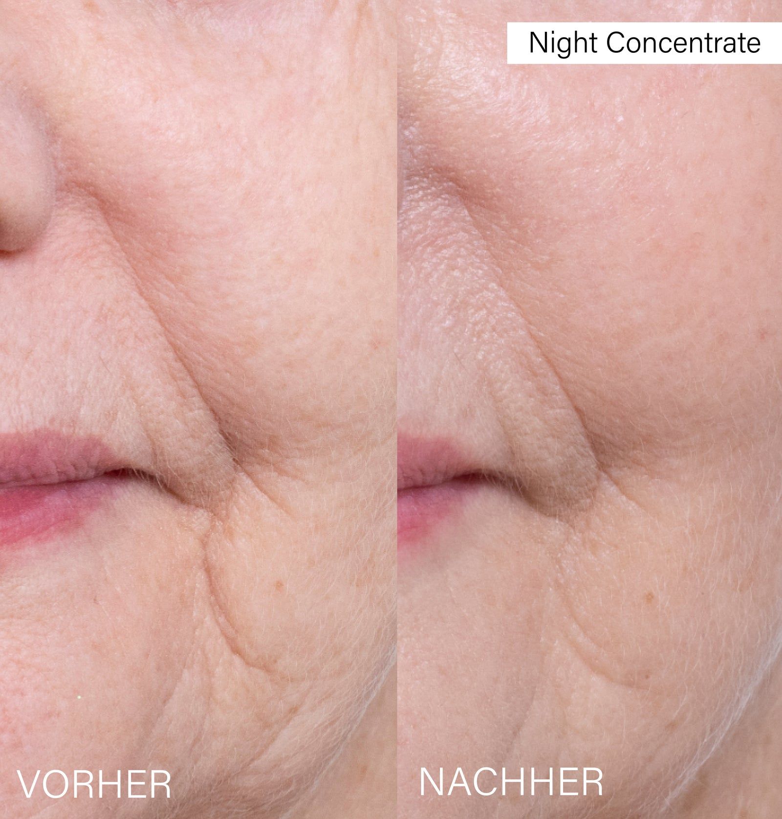 Gesicht, Vorher-Nachher-Vergleich. Falten sichtbar. Text: Vorher, Nachher, Night Concentrate.