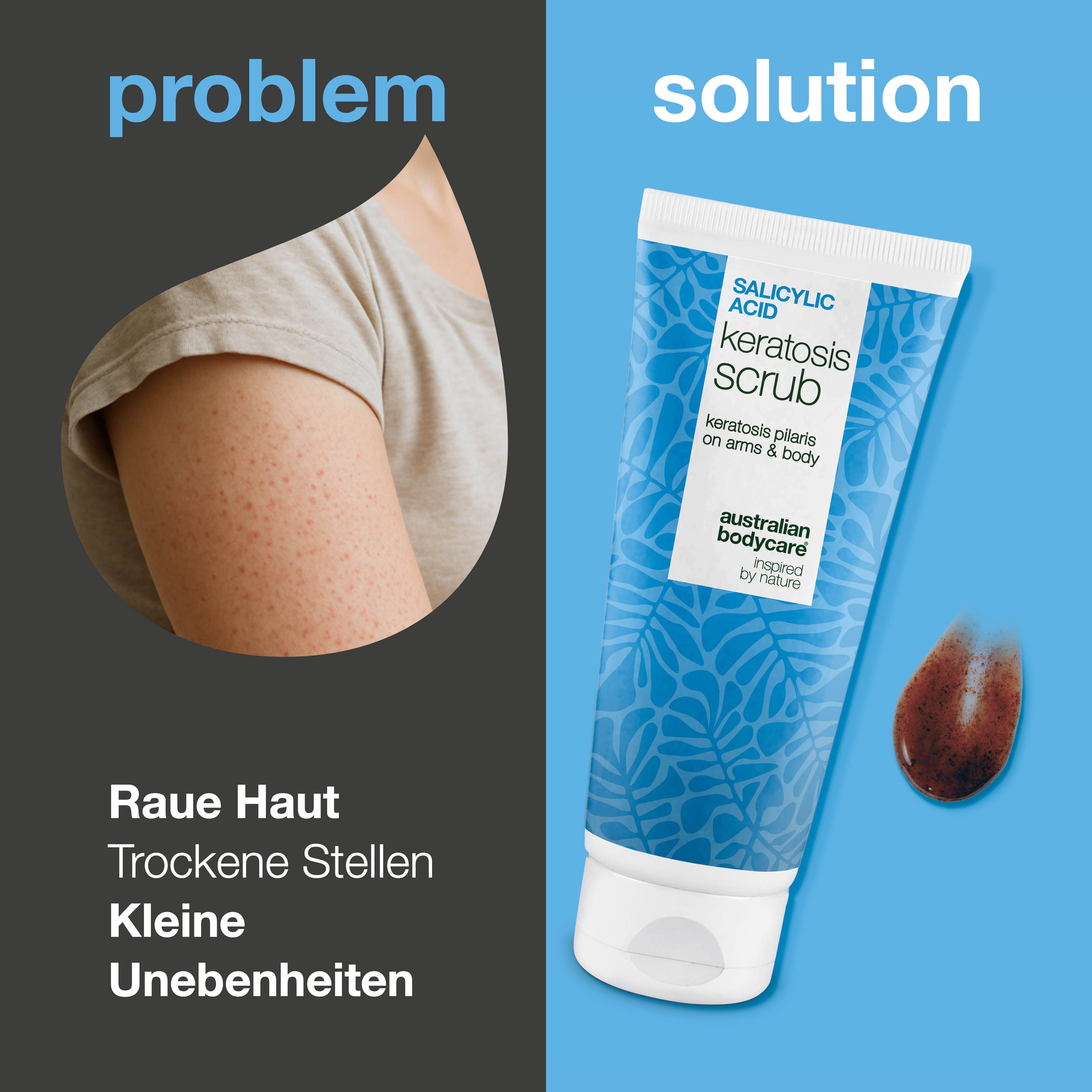 Arm mit rauer Haut neben Tube mit Keratosis Scrub. Text: Salicylsäure, Keratosis Scrub. Braune Scrub-Probe.