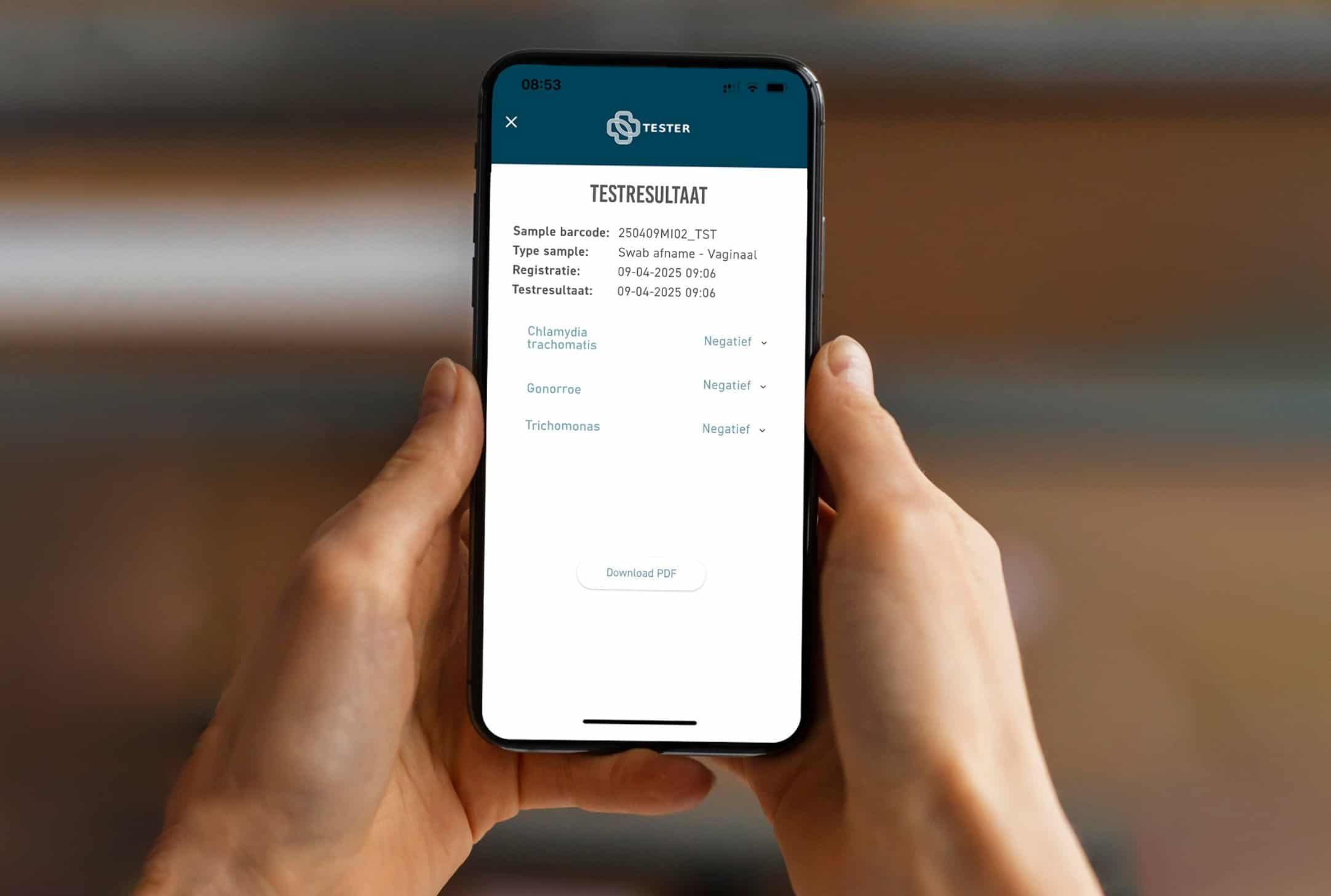 Tester App zeigt Testergebnis für Chlamydien, Gonorrhoe und Trichomonaden an. Negativ.