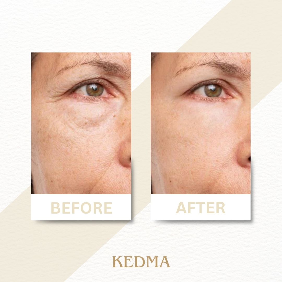 Kedma - Anti-Aging-Serum mit Mineralien, Vitamin A, C, E