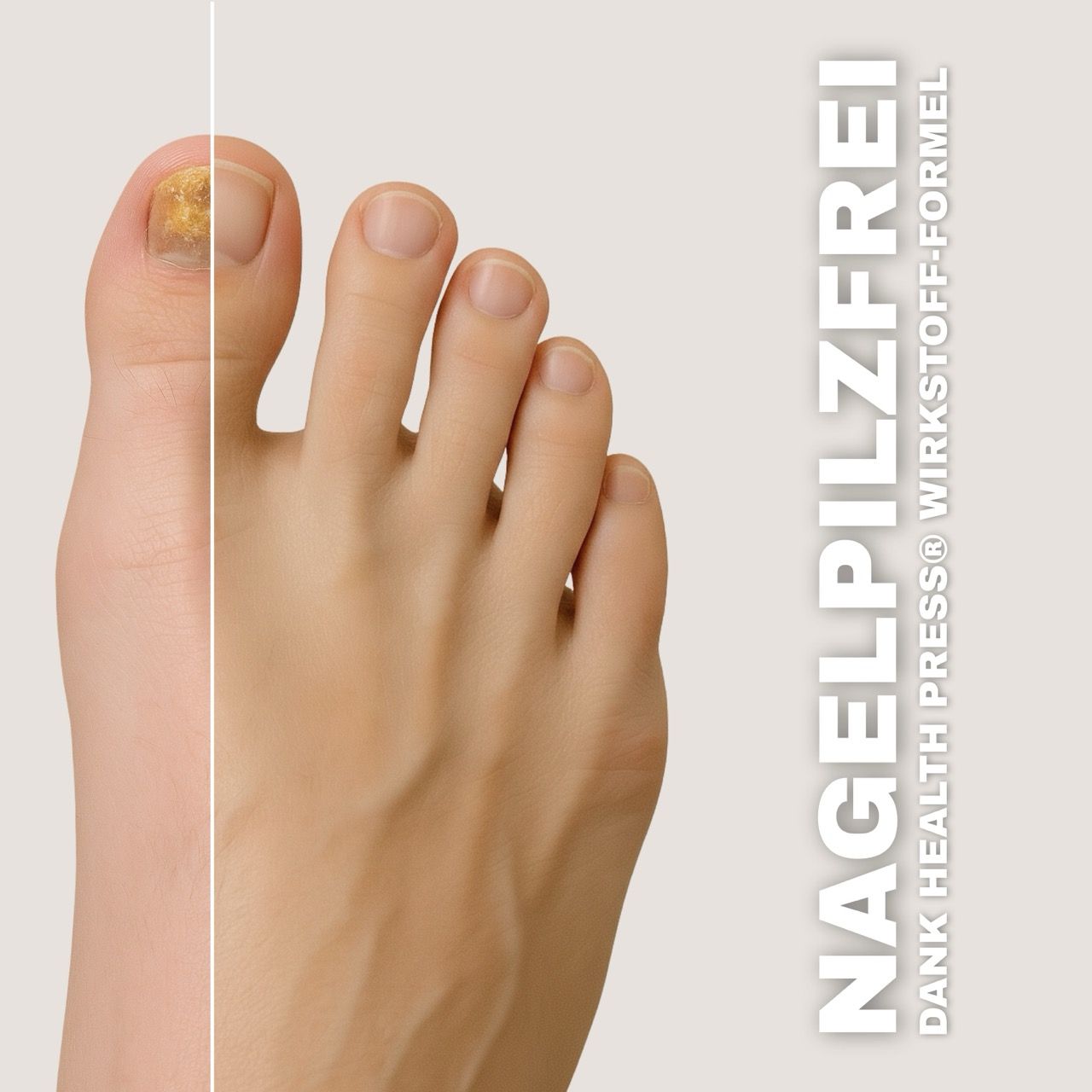 Health Press Nagelpilz Stift 3er Set – Nagelpilz Lack für schnelle & effektive Behandlung