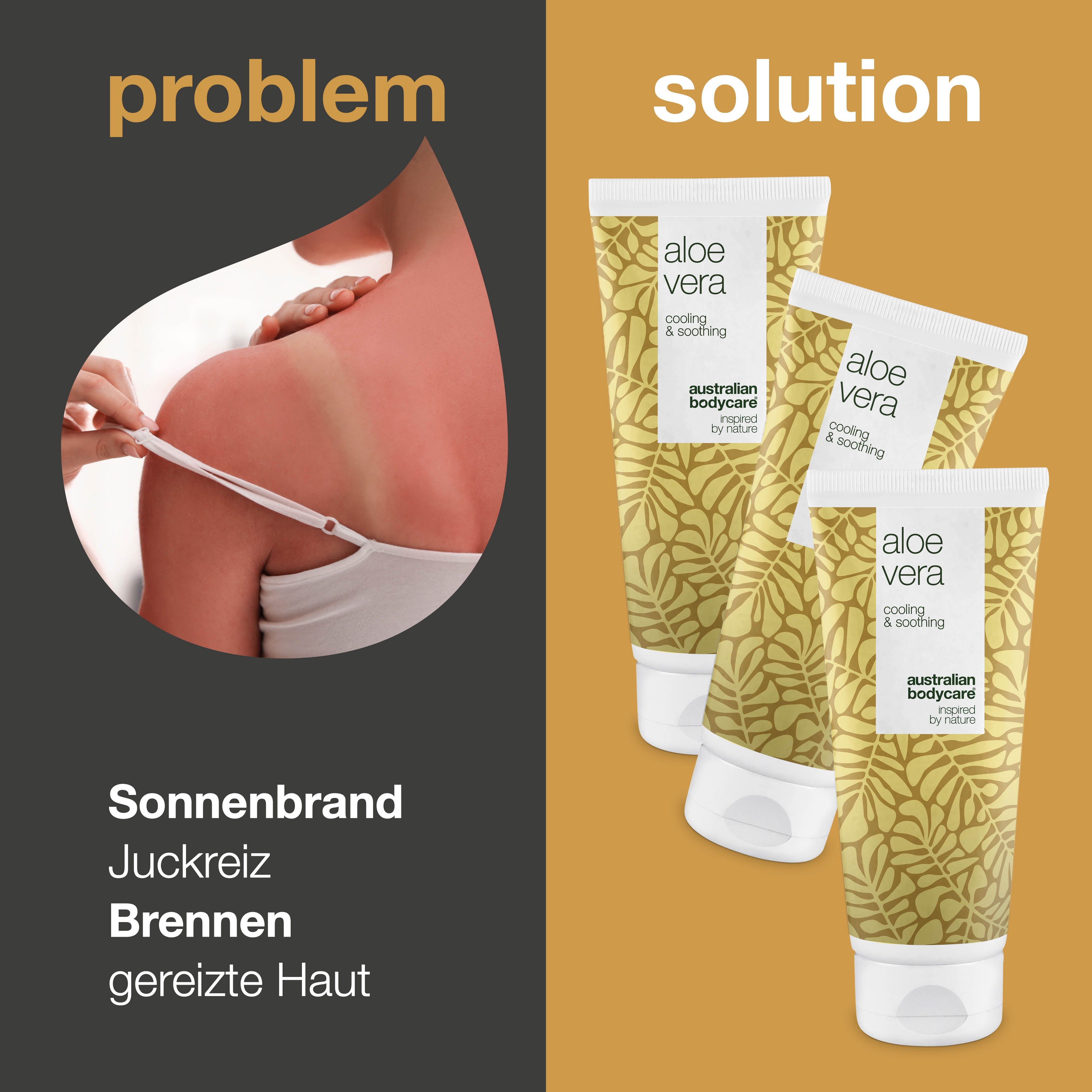 Aloe Vera Gel-Lösung für Hautprobleme. Drei Tuben Aloe Vera Gel. Marke: Australian Bodycare.