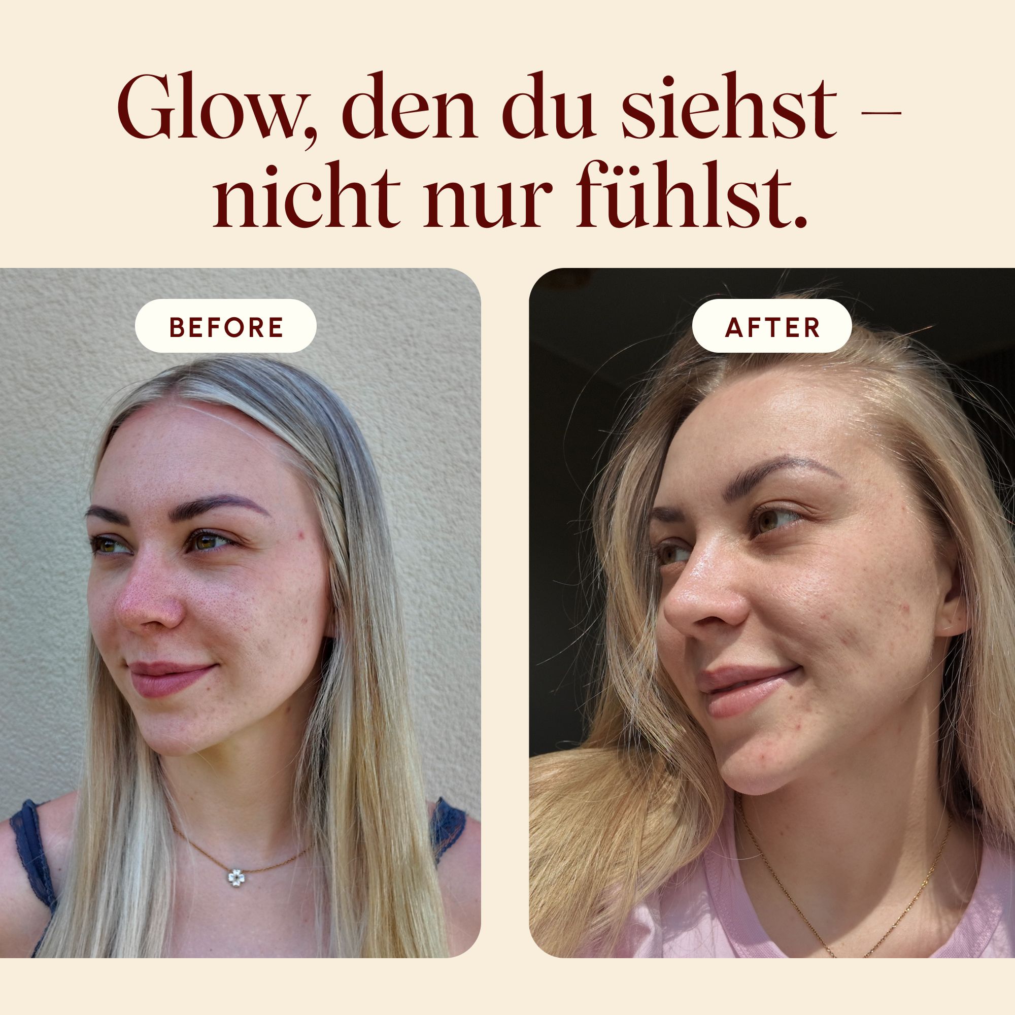 VETAIN Kollagenpulver Vegan - Mit VeCollal®, Vitamin C, Zink & Biotin - Für Haut, Haare & Nägel