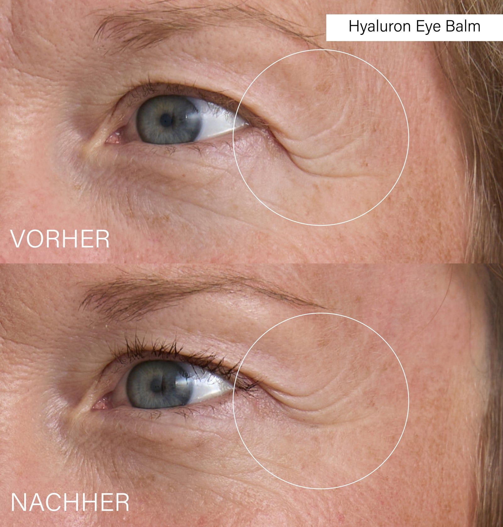 Vergleichsbild: Auge vor und nach Anwendung. Faltenreduzierung durch Produkt. Text: Hyaluron Eye Balm.
