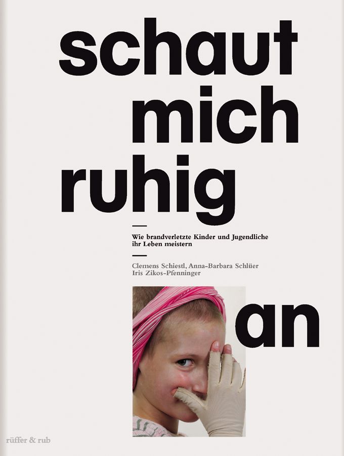 Buchcover mit Titel "schaut mich ruhig an". Untertitel: Wie brandverletzte Kinder und Jugendliche ihr Leben meistern. Autorennamen. Foto eines Kindes.