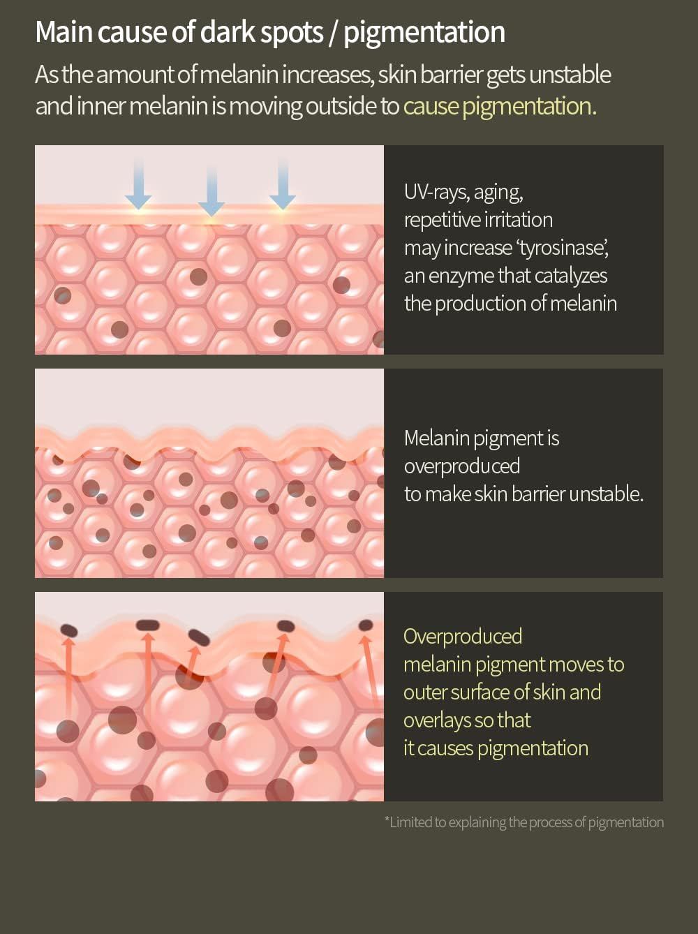 Diagramm, das die Ursache von Pigmentierung zeigt. UV-Strahlen, Alterung und Reizungen können Melaninproduktion erhöhen.