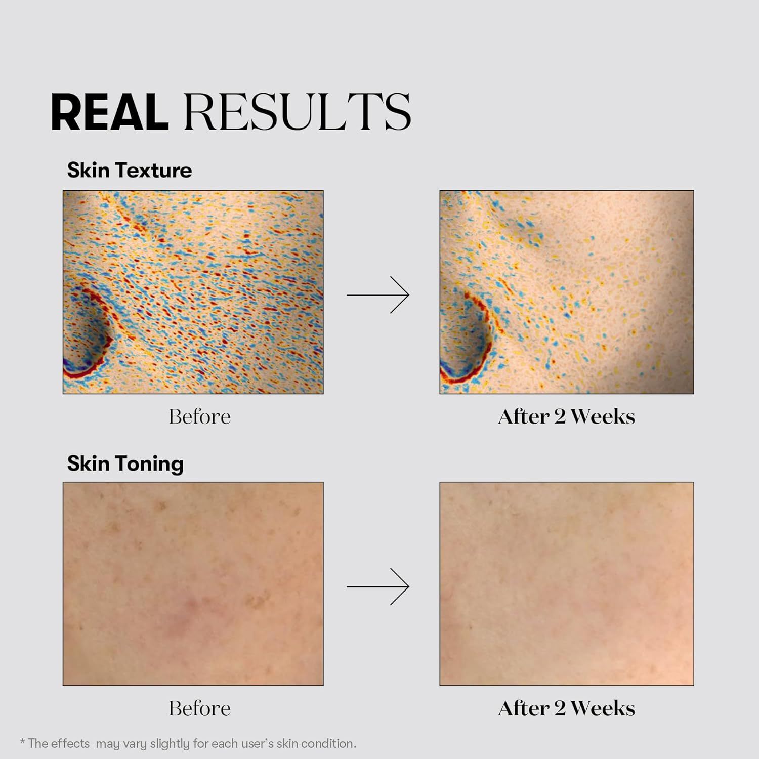 VT COSMETICS TX-Toning Essenz 1000 Shot