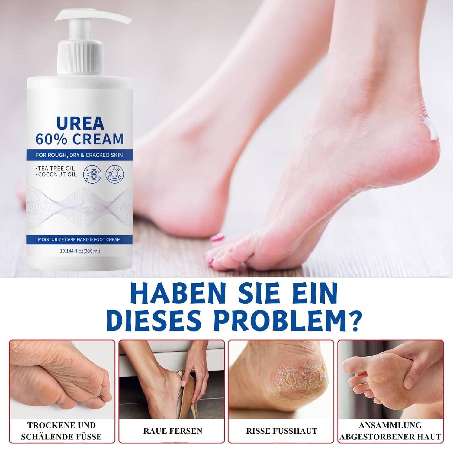 SUMMISHI Urea Creme 60 Prozent