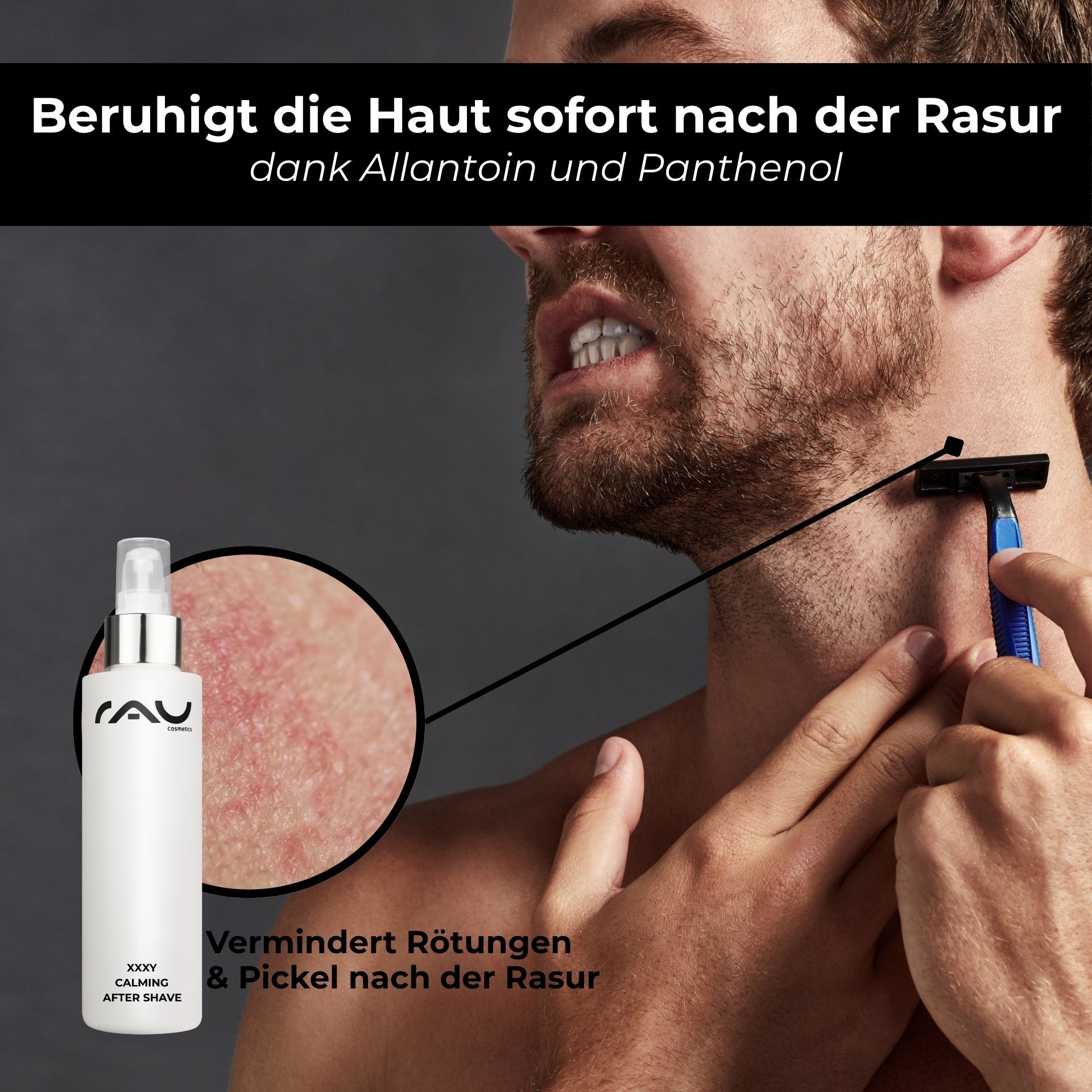 Mann rasiert sich. Daneben Flasche RAU XXXY Calming After Shave. Vergrößerung: gerötete Haut.