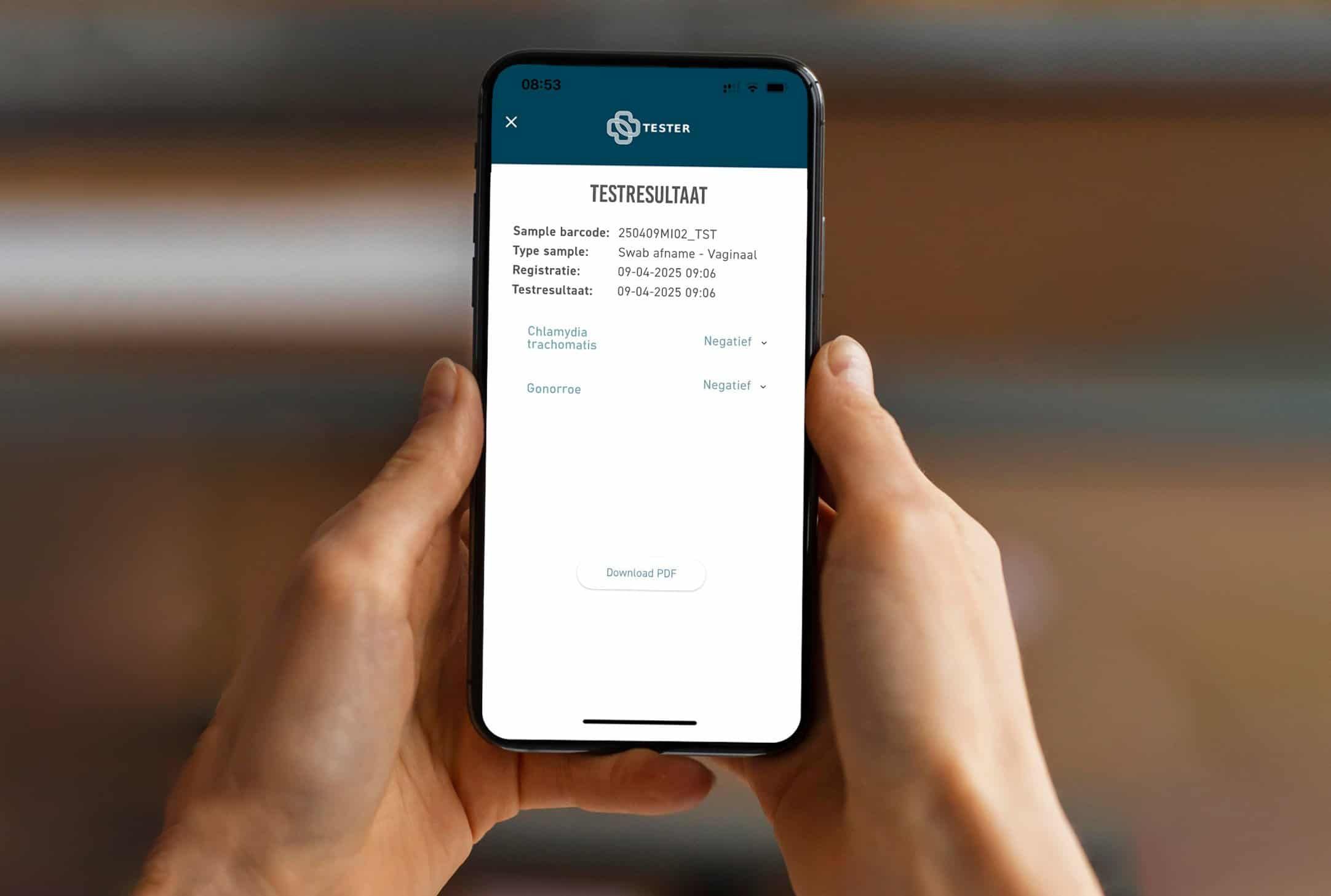 Smartphone zeigt Testergebnis für Chlamydien- & Gonorrhoe-Test an.