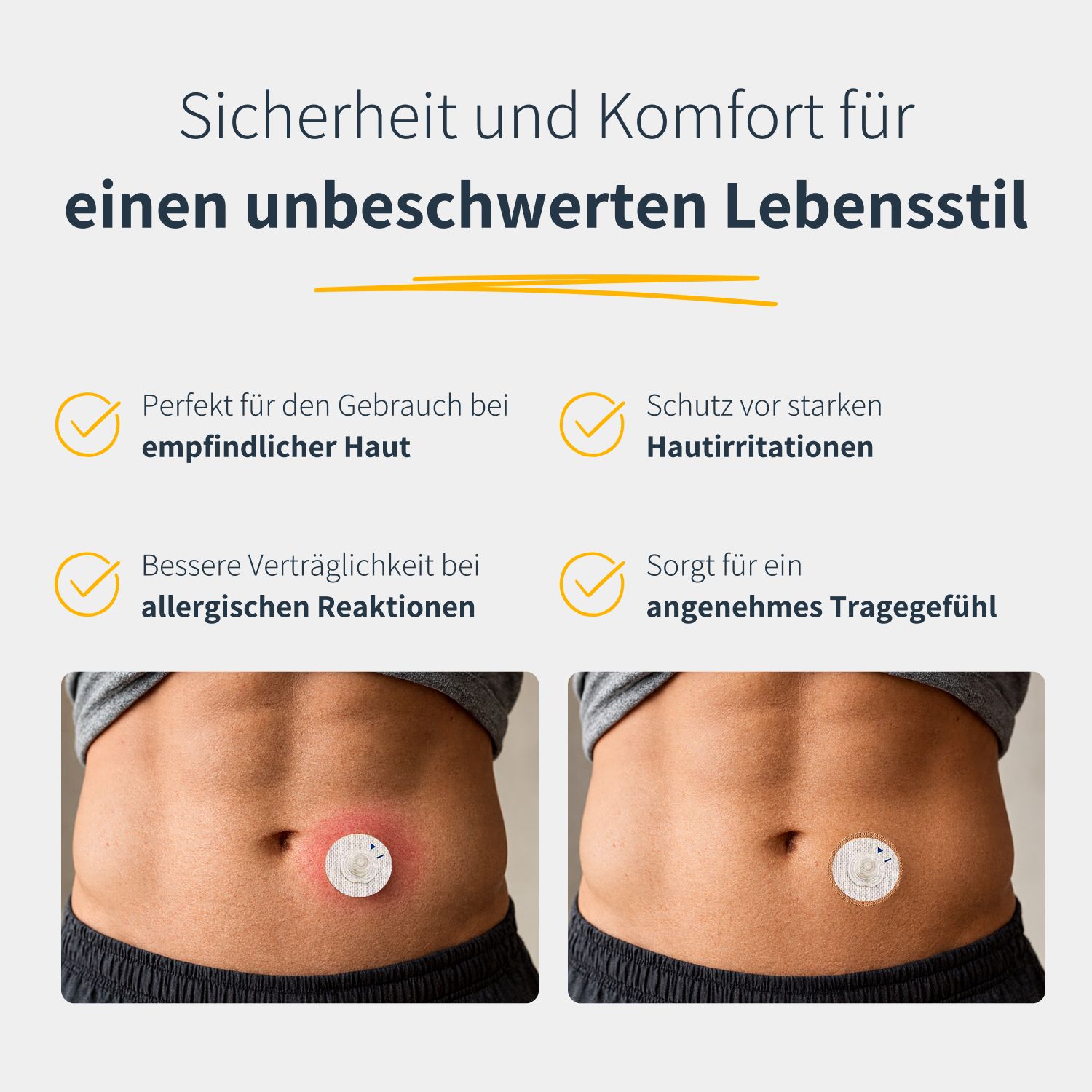 Bauch mit Katheter-Underpatch. Links: Hautirritation. Rechts: Patch ohne Irritation. Text: Sicherheit und Komfort. Piktogramme.