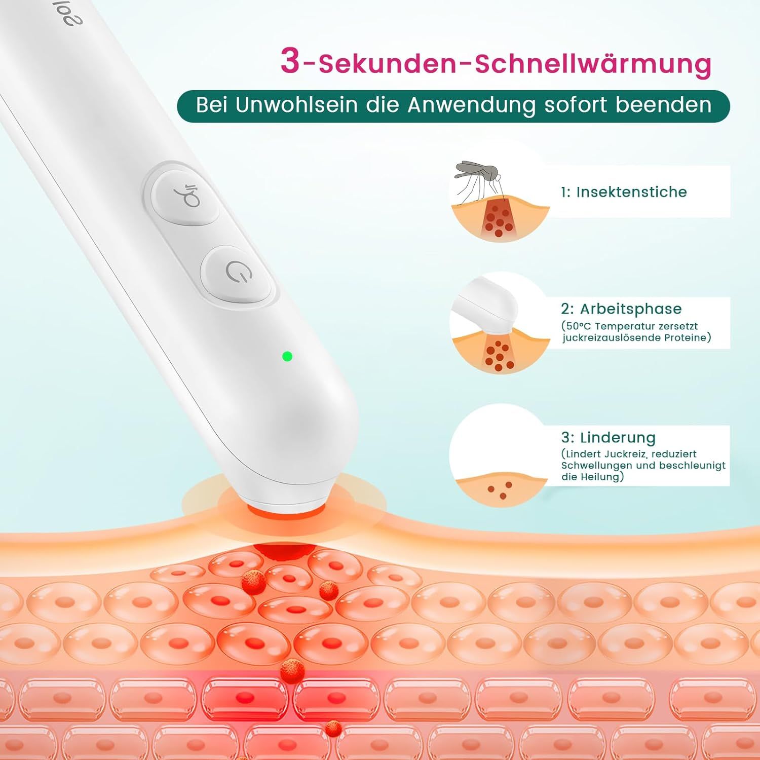 Nahaufnahme des weißen Insektenstichheilers. Illustration der Wirkung auf die Haut. Text über die Anwendung.