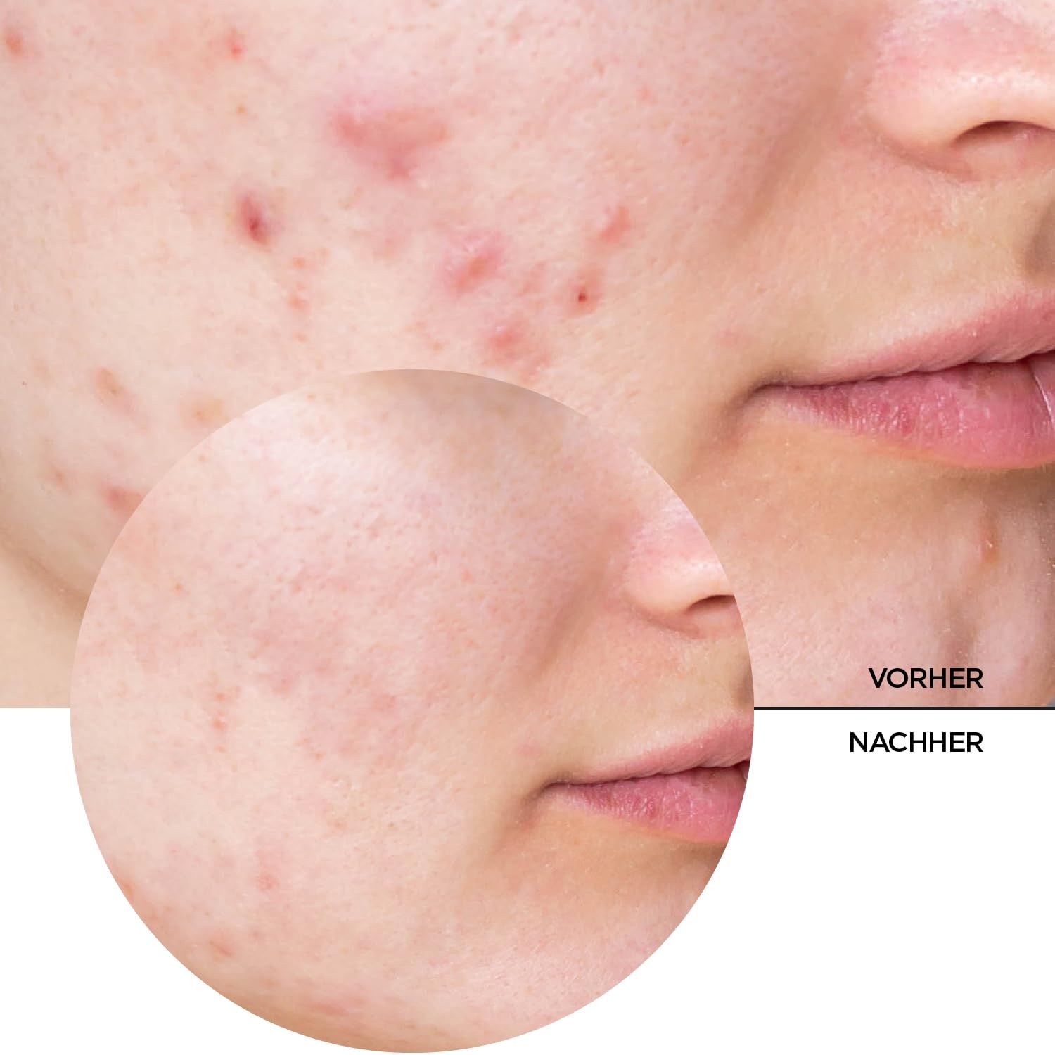 Tropfen eines klaren Serums, das aus einer Pipette fällt. Wasserbasiertes, leichtes, ölfreies Serum.