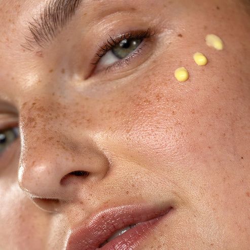 Gesicht einer Frau mit Sommersprossen. Auf der Haut sind drei gelbe Cremepunkte sichtbar.