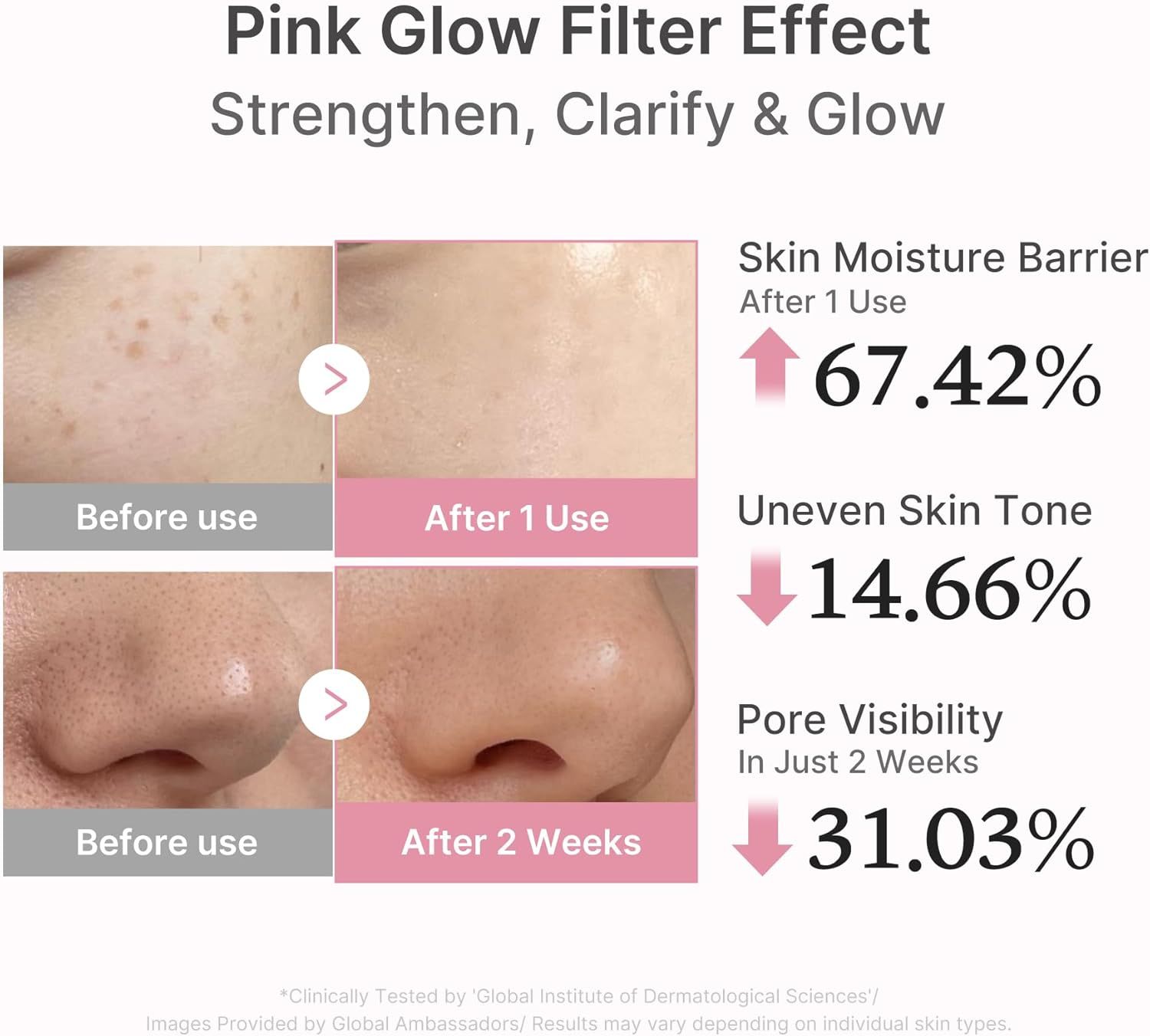 Vorher-Nachher-Vergleich von Haut. Text: Skin Moisture Barrier +67,42%, Uneven Skin Tone -14,66%, Pore Visibility -31,03%.