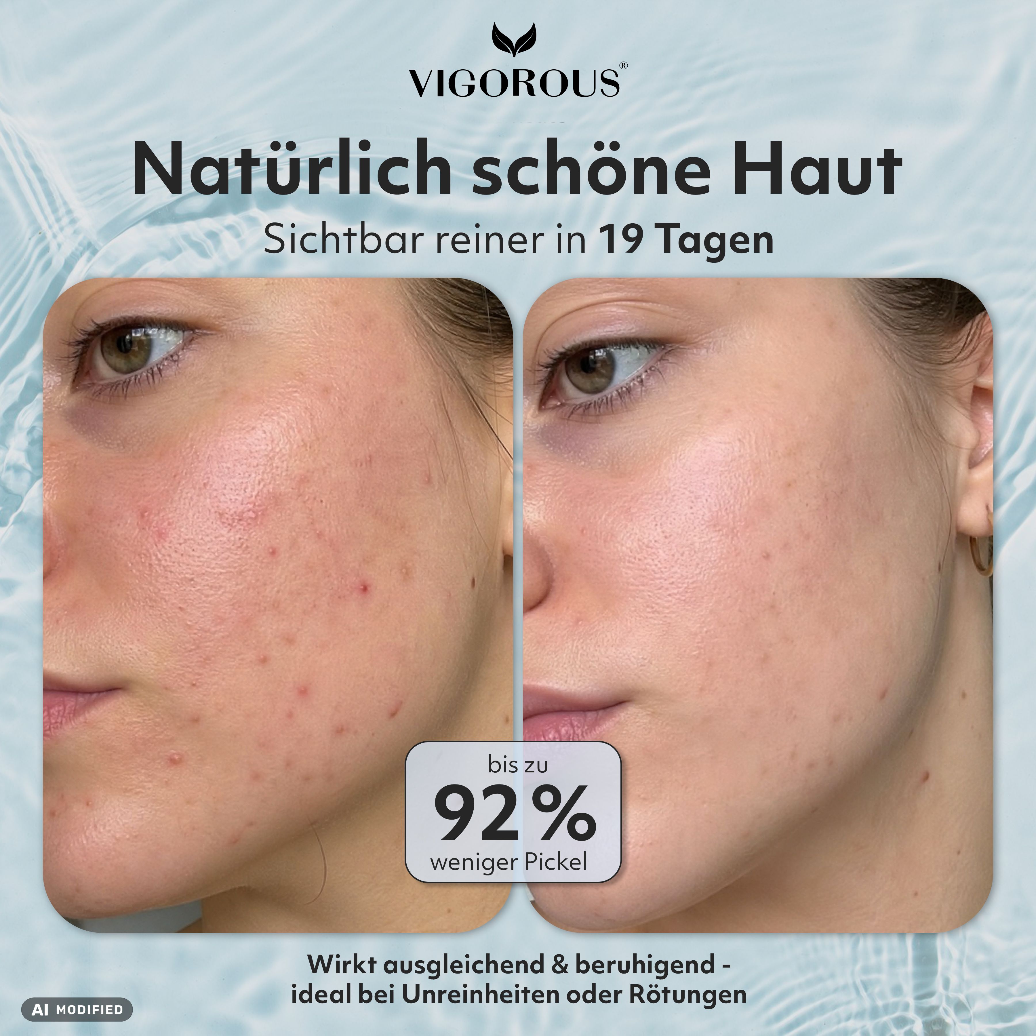 Vorher/Nachher-Vergleich: Hautbild mit weniger Pickeln nach 19 Tagen.