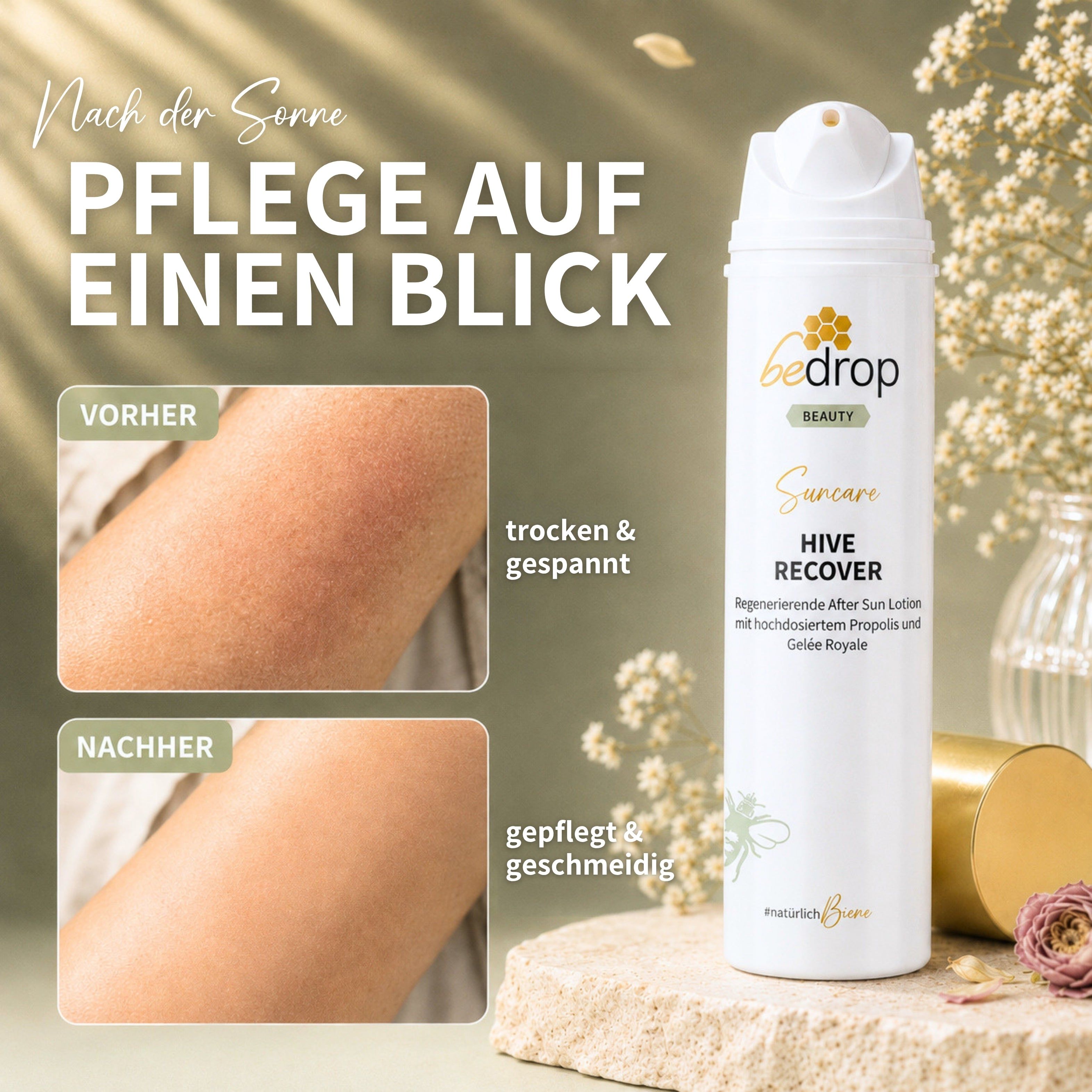 HIVE RECOVER - regenerierende After Sun Lotion mit hochdosiertem Gelée Royale & Propolis