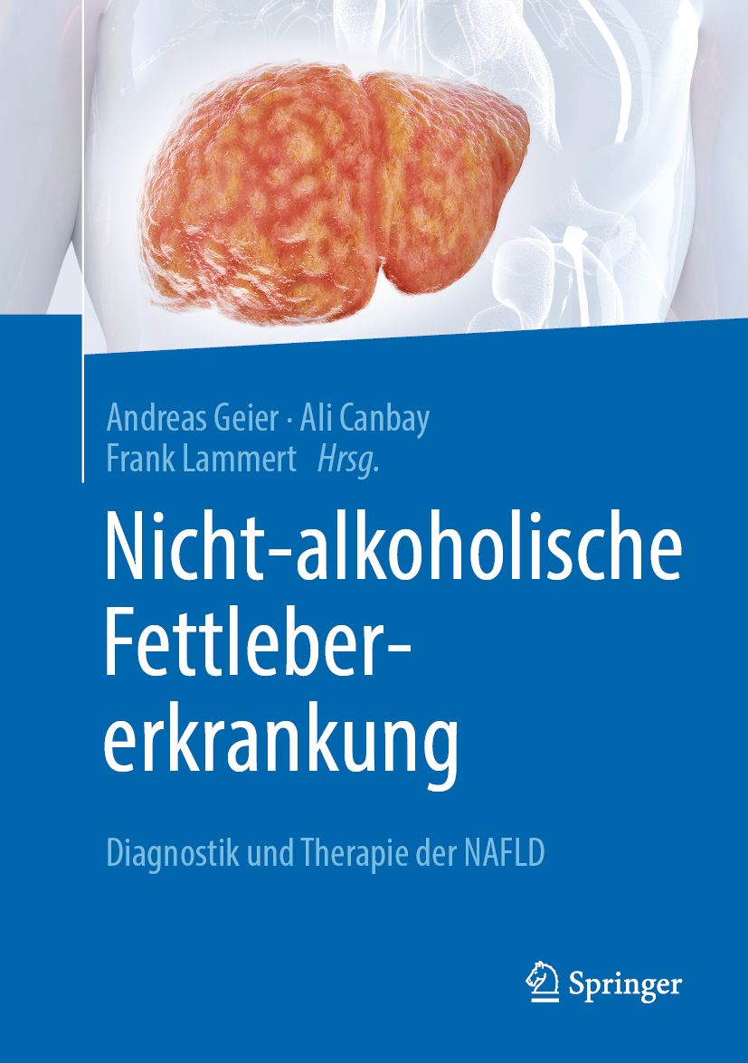Buchcover mit Titel: Nicht-alkoholische Fettlebererkrankung. Autoren: Andreas Geier, Ali Canbay, Frank Lammert. Verlag: Springer.