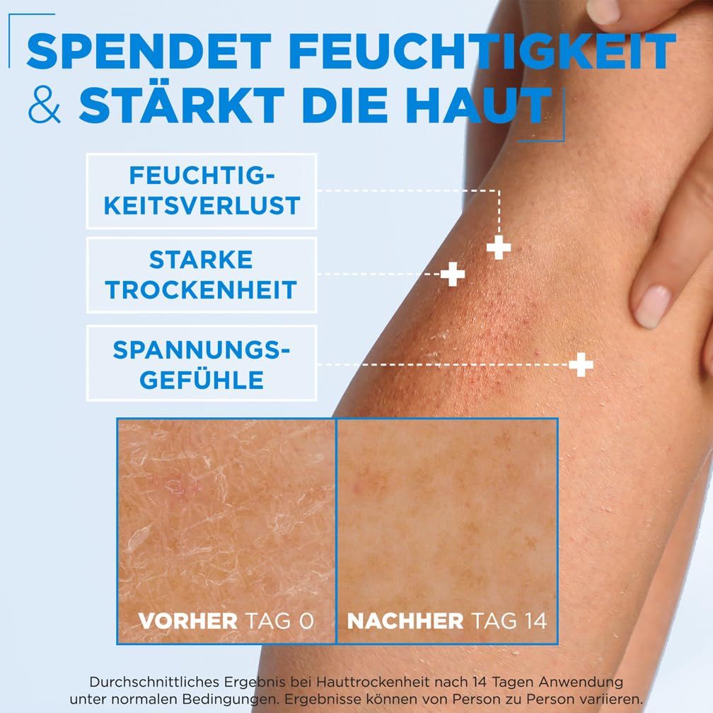 Haut mit Trockenheit, Spannungsgefühlen. Vorher/Nachher-Vergleich. Text: Spendet Feuchtigkeit & stärkt die Haut. Ergebnisse können variieren.