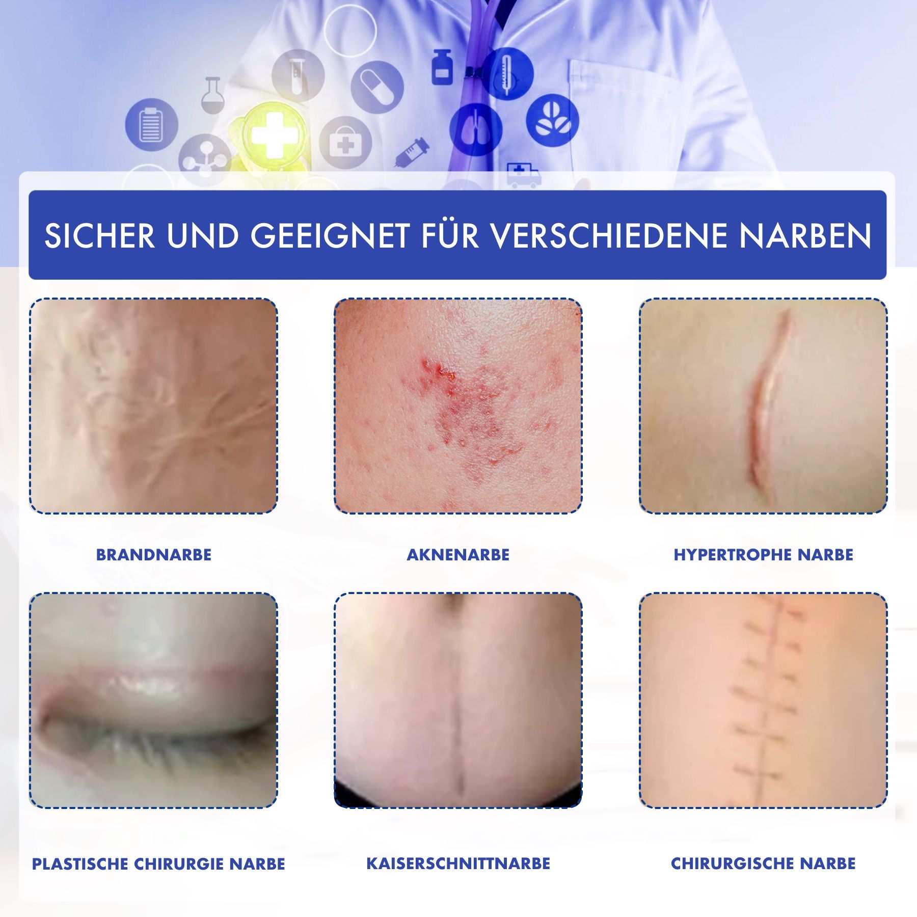 Verschiedene Narbenarten. Text: Brandnarbe, Aknenarben, hypertrophe Narbe, plastische Chirurgie, Kaiserschnittnarbe, chirurgische Narbe.