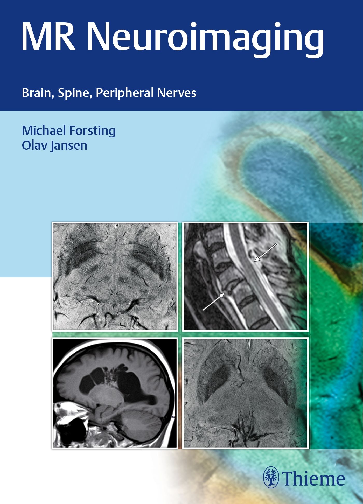 Buchcover mit Titel MR Neuroimaging. Untertitel: Brain, Spine, Peripheral Nerves. Autoren: Michael Forsting, Olav Jansen. Verlag: Thieme.